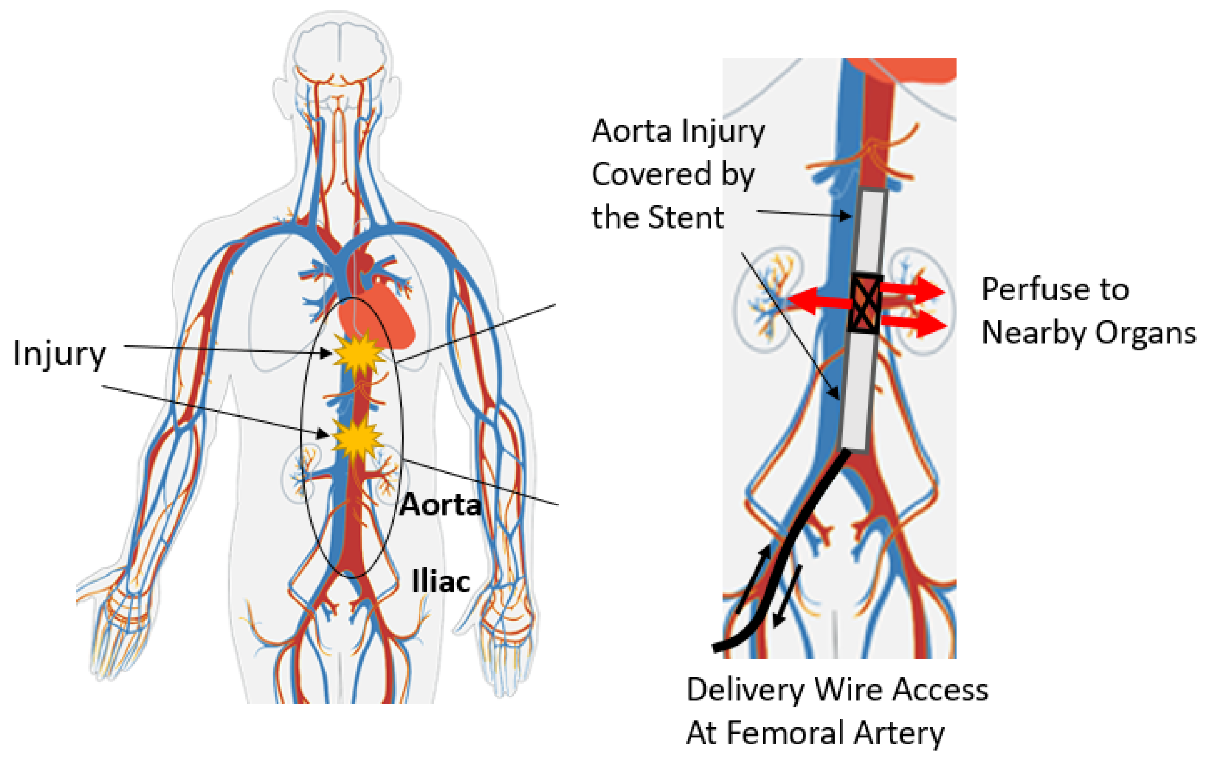 Sensors 23 04887 g001