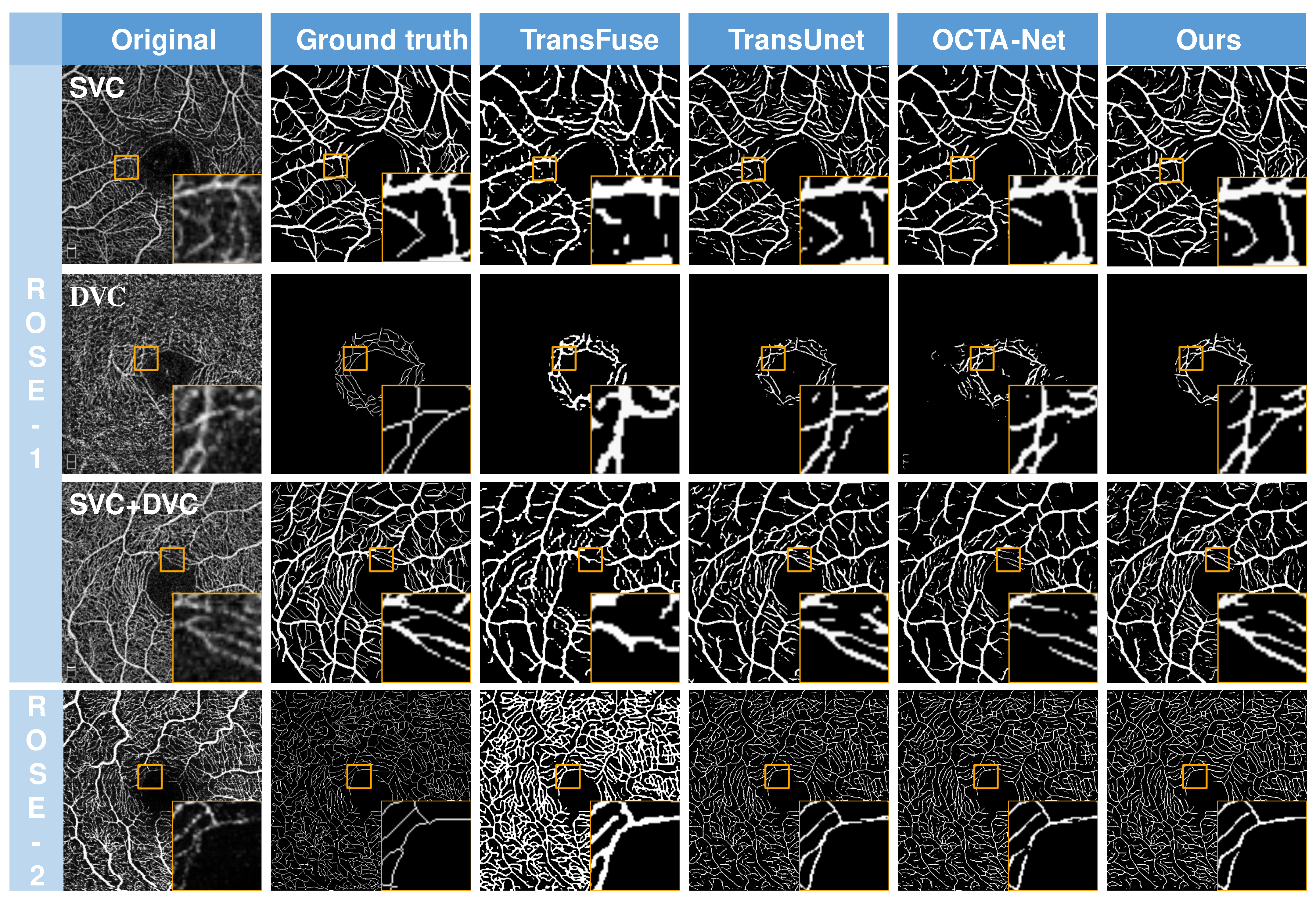 Sensors 23 04897 g005