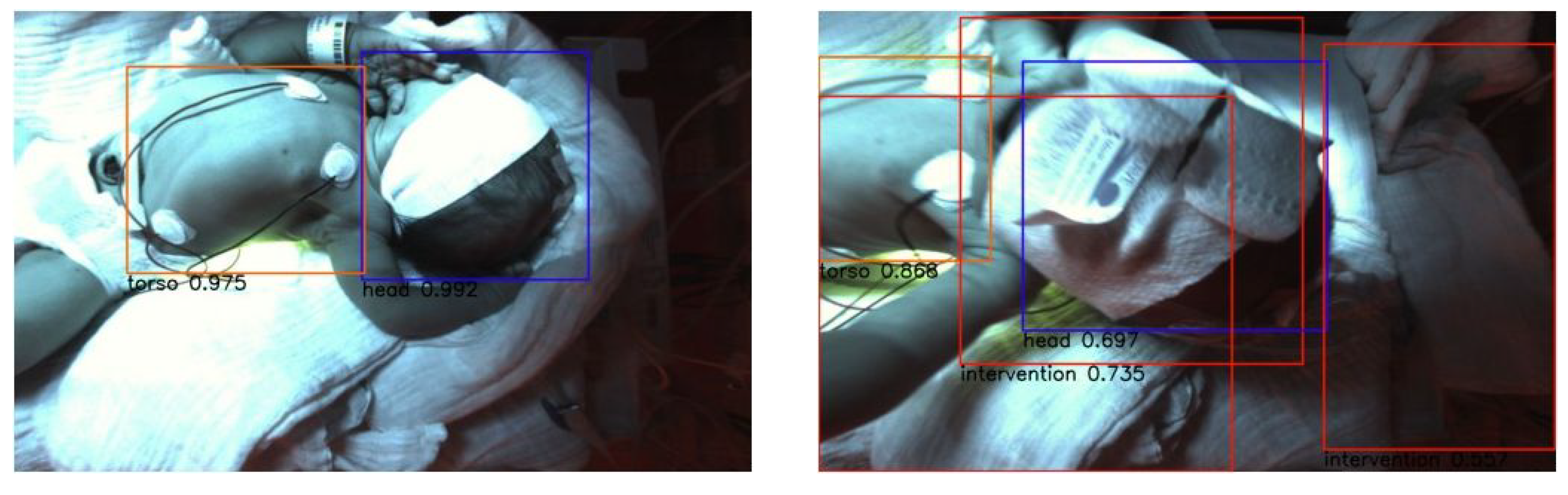Sensors 23 04910 g013 Sensors 23 04910 g013