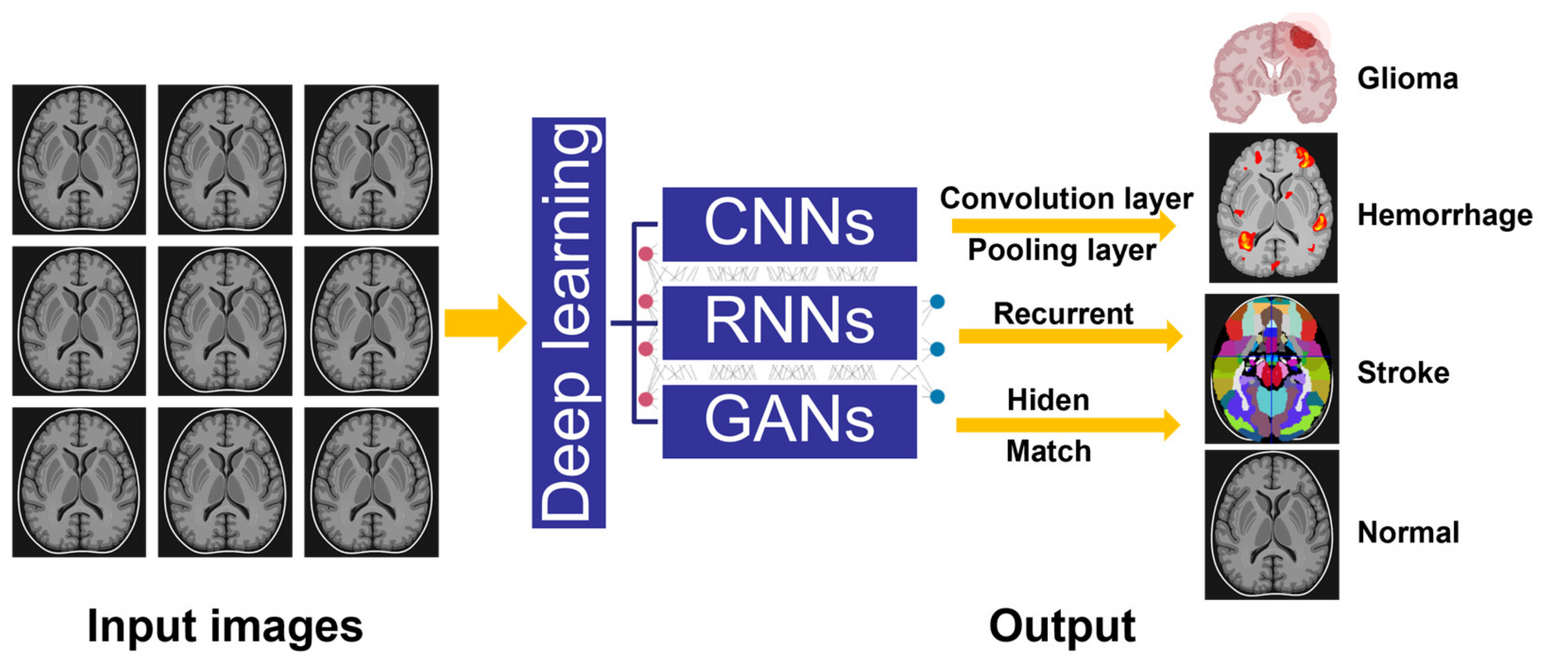 Sensors | Free Full-Text | Deep Learning Aided Neuroimaging and Brain ...