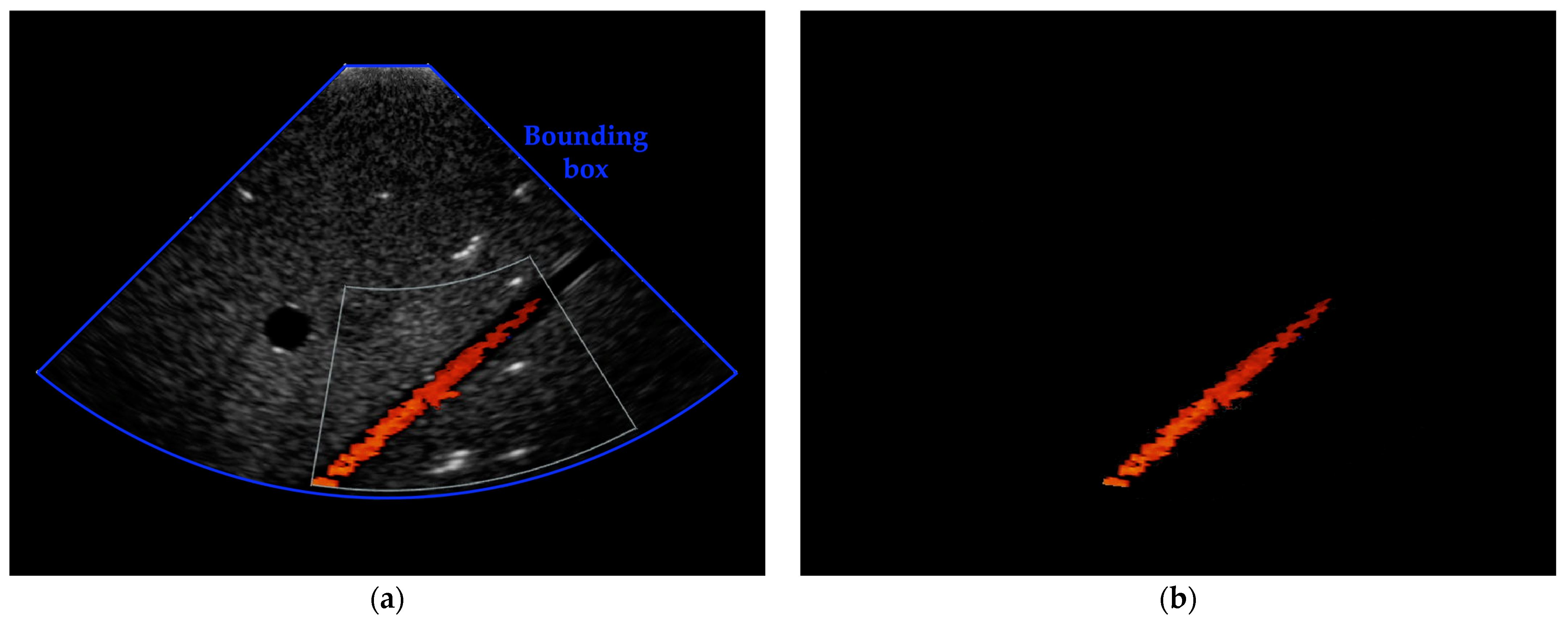 Sensors 23 05005 g003