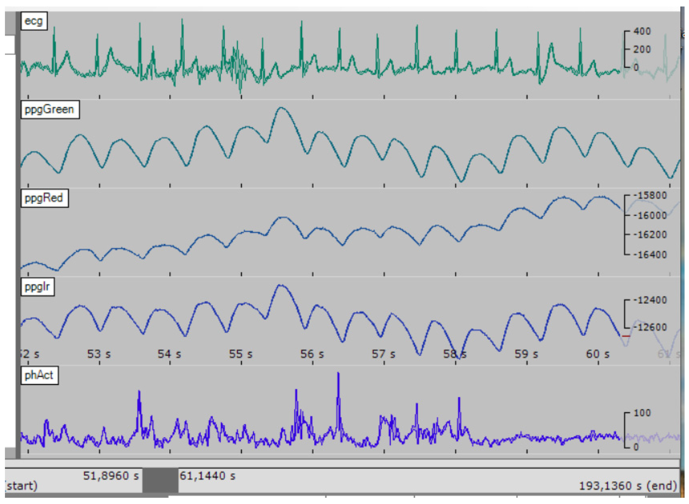 Sensors 23 05144 g008