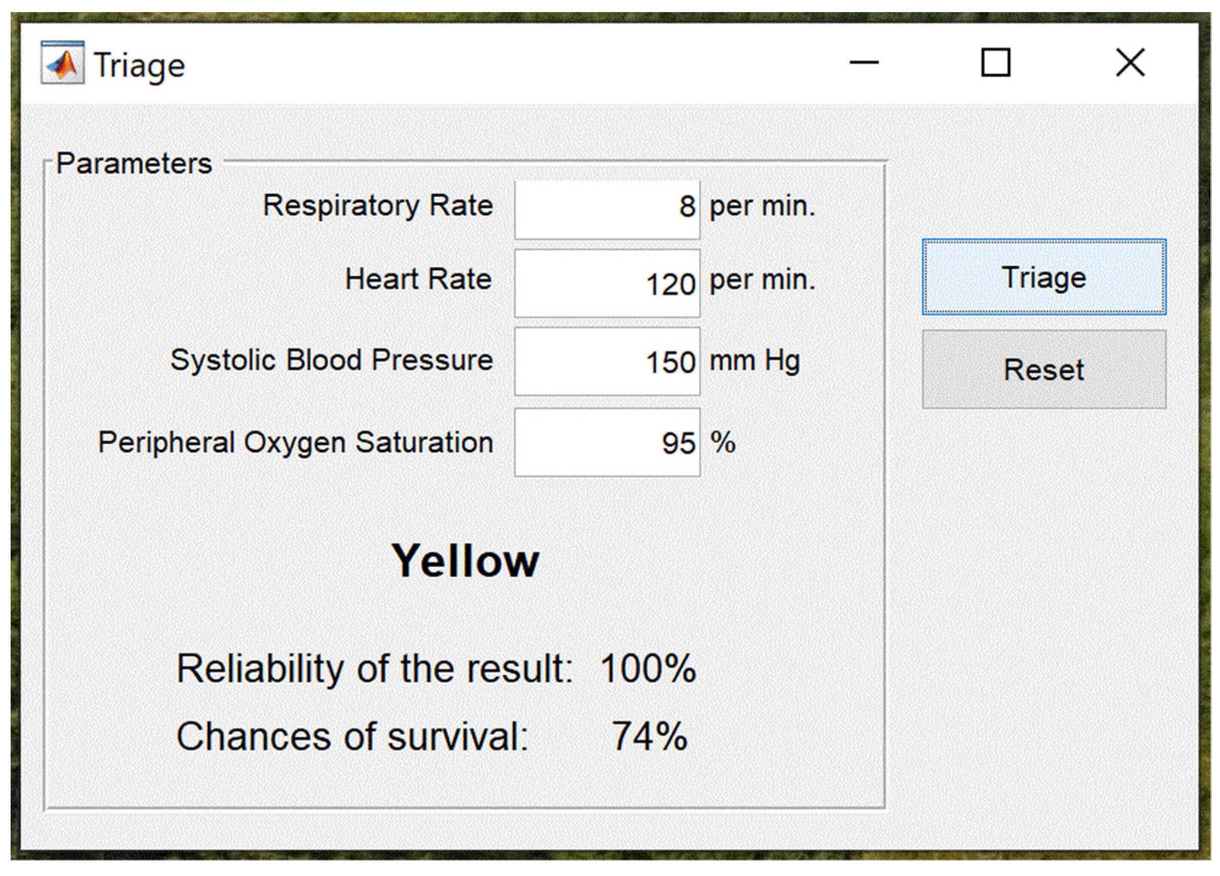 Sensors 23 05144 g013