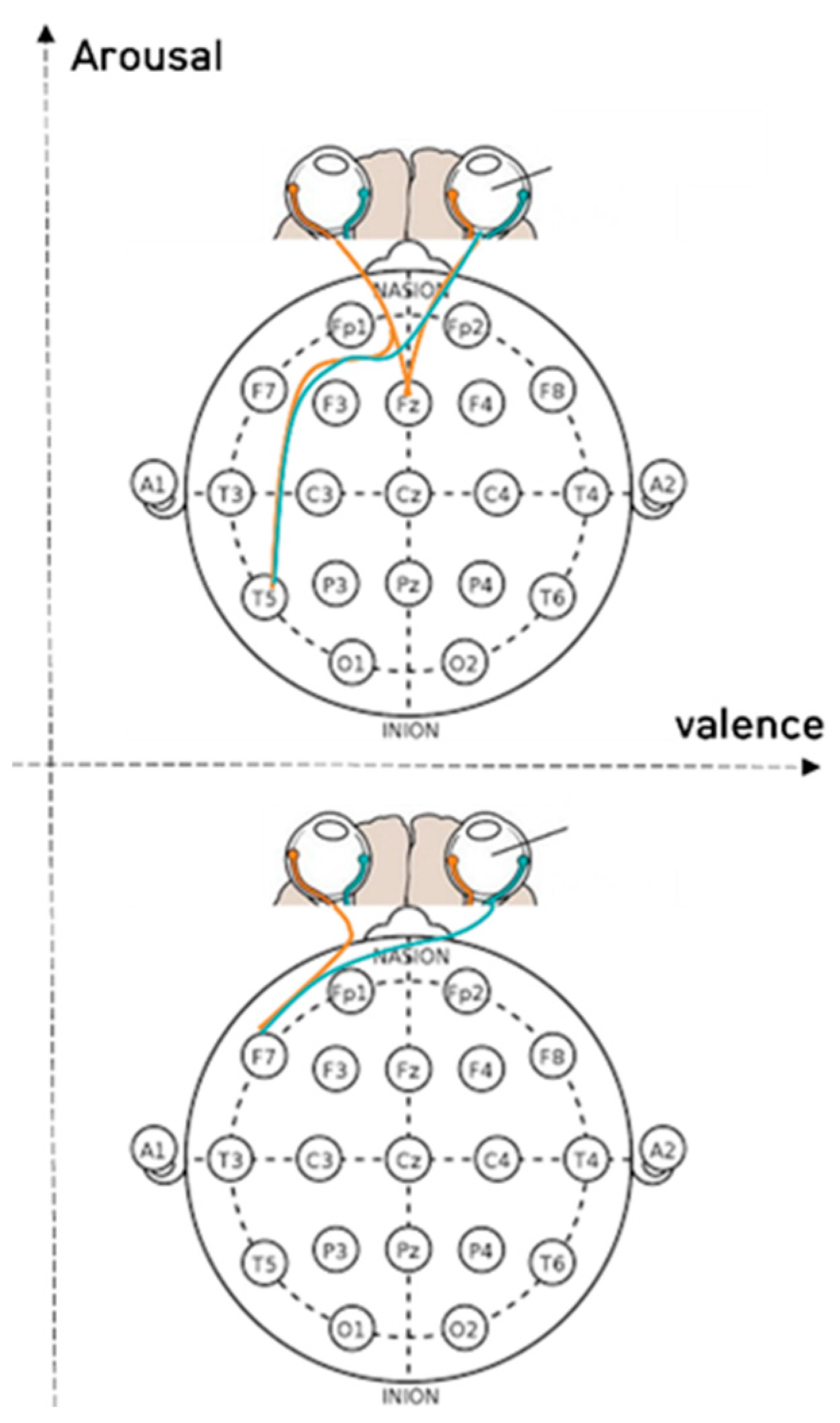 Sensors 23 05162 g006