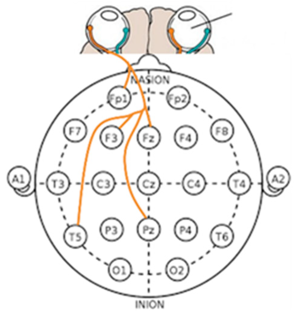Sensors 23 05162 g012