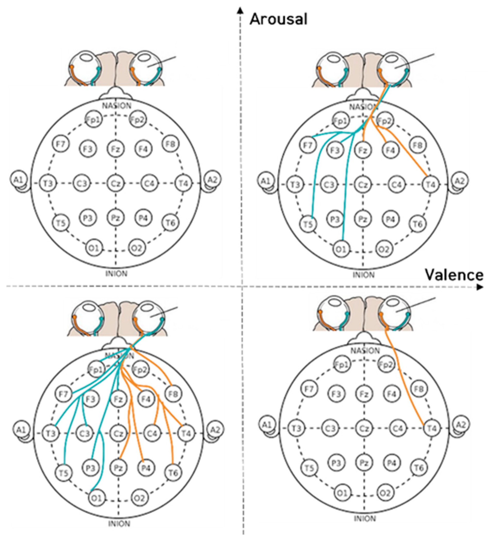 Sensors 23 05162 g017