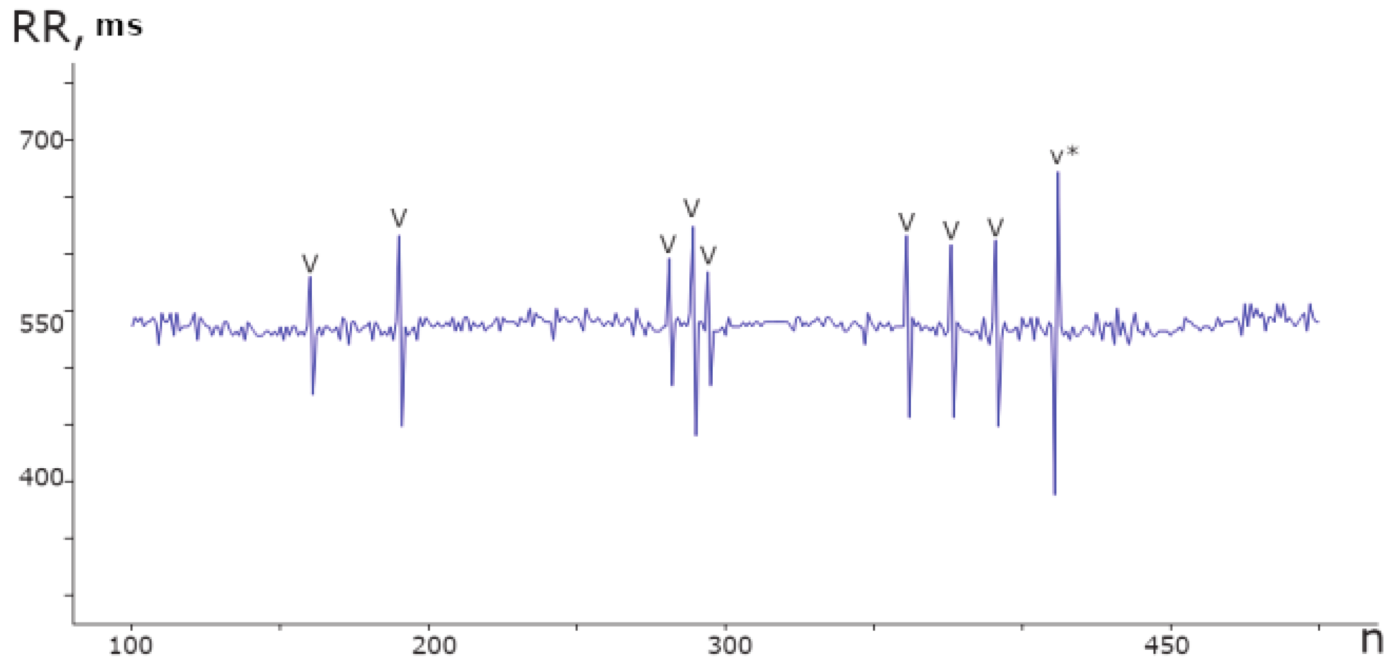 Sensors 23 05272 g006