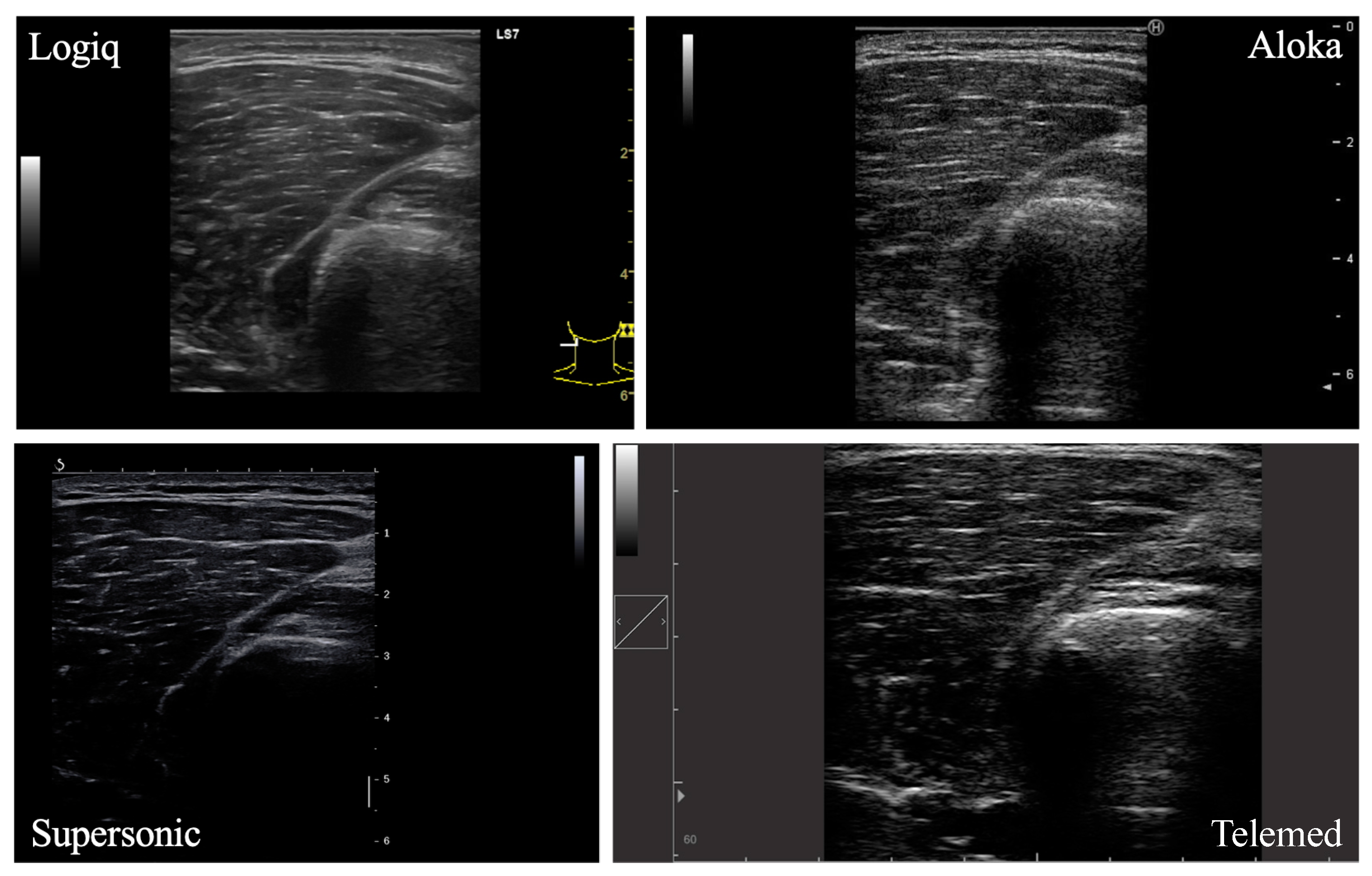 Sensors 23 05282 g001
