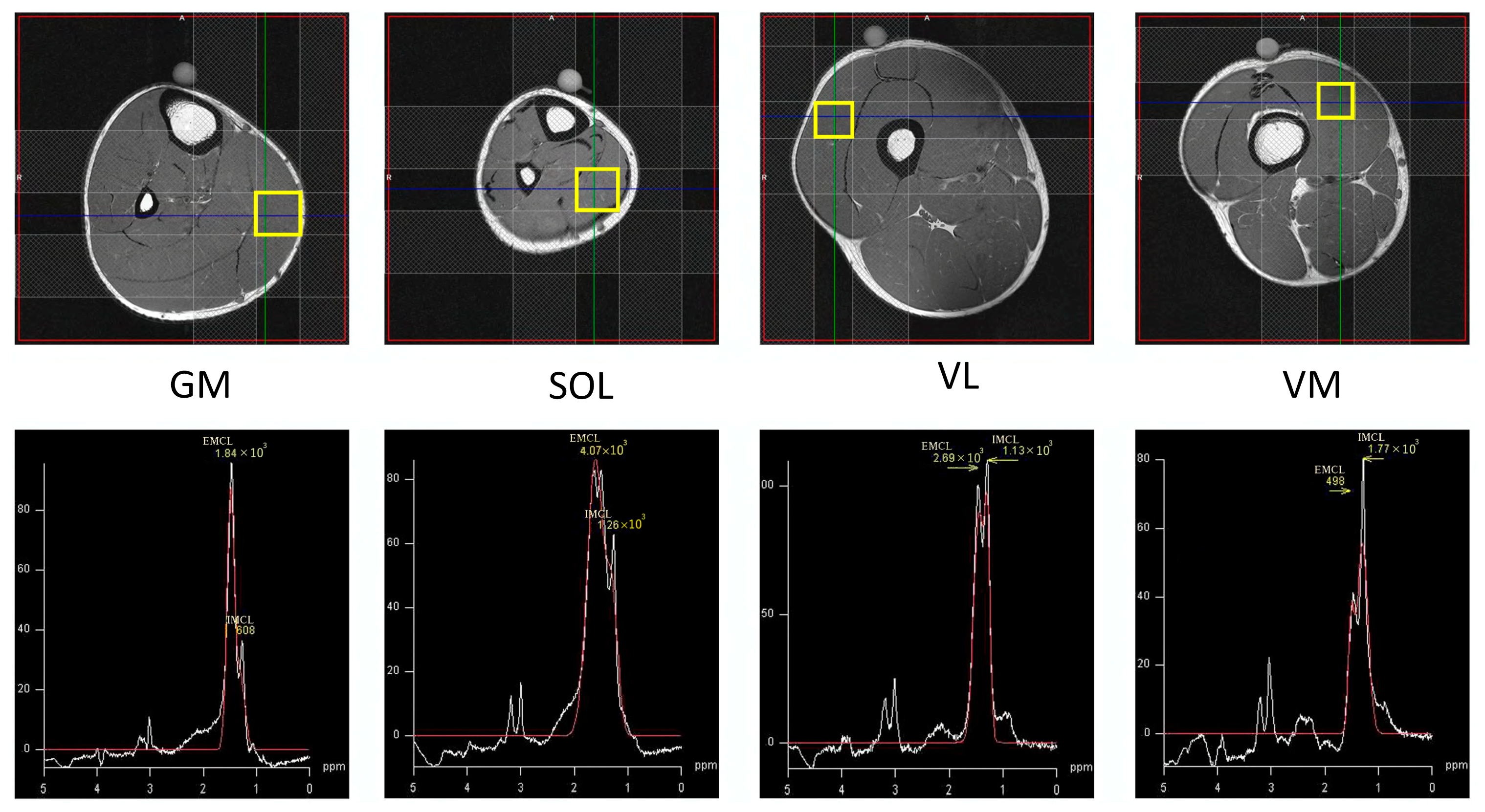 Sensors 23 05282 g002
