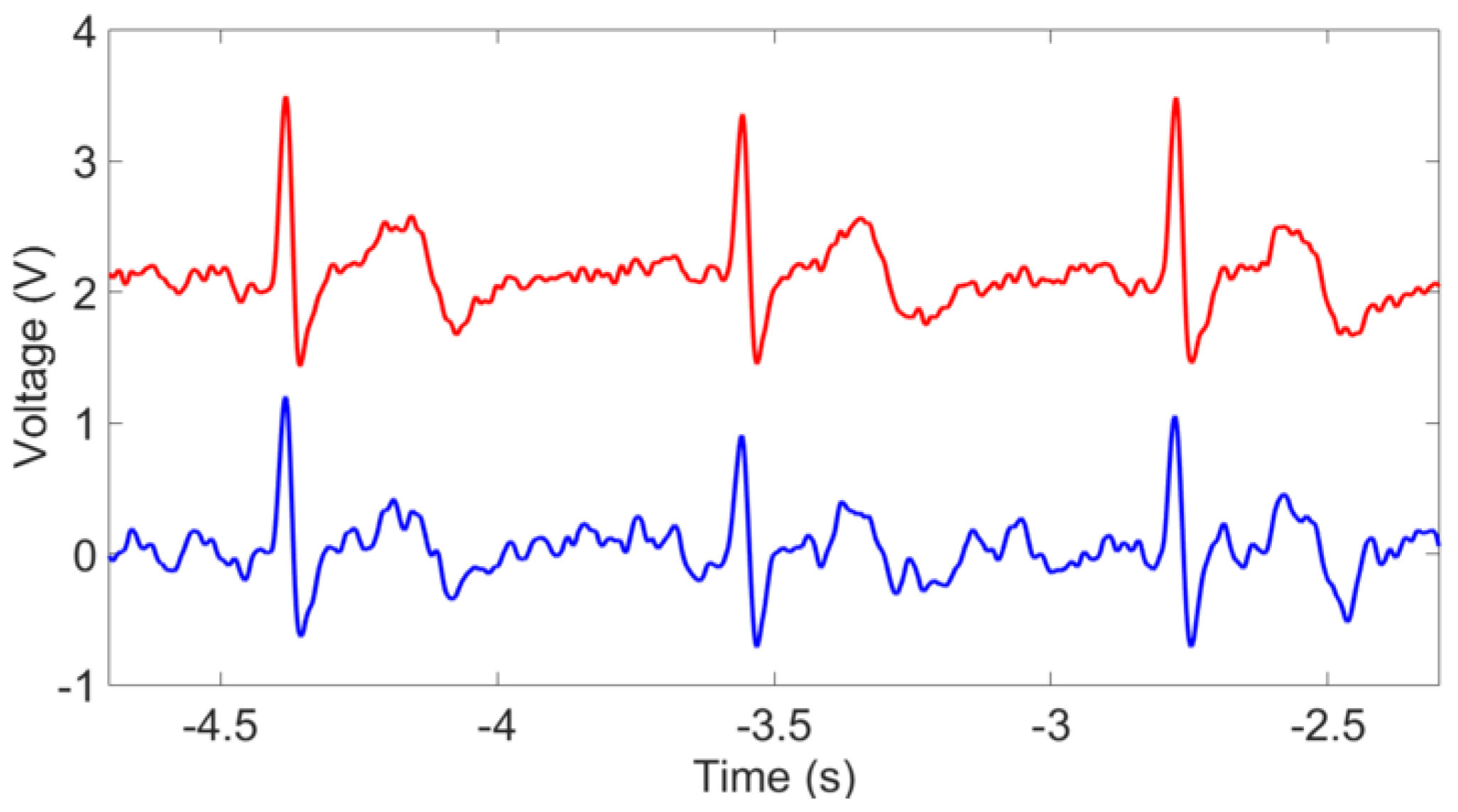 Sensors 23 05283 g013b