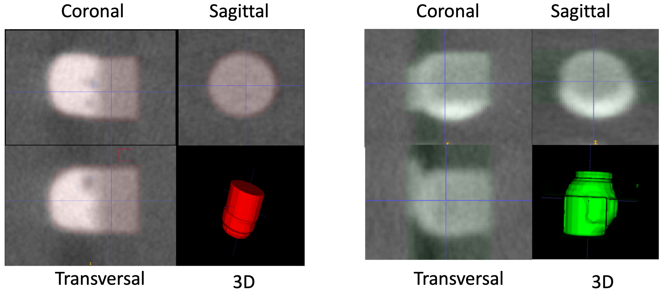 Sensors 23 05470 g009
