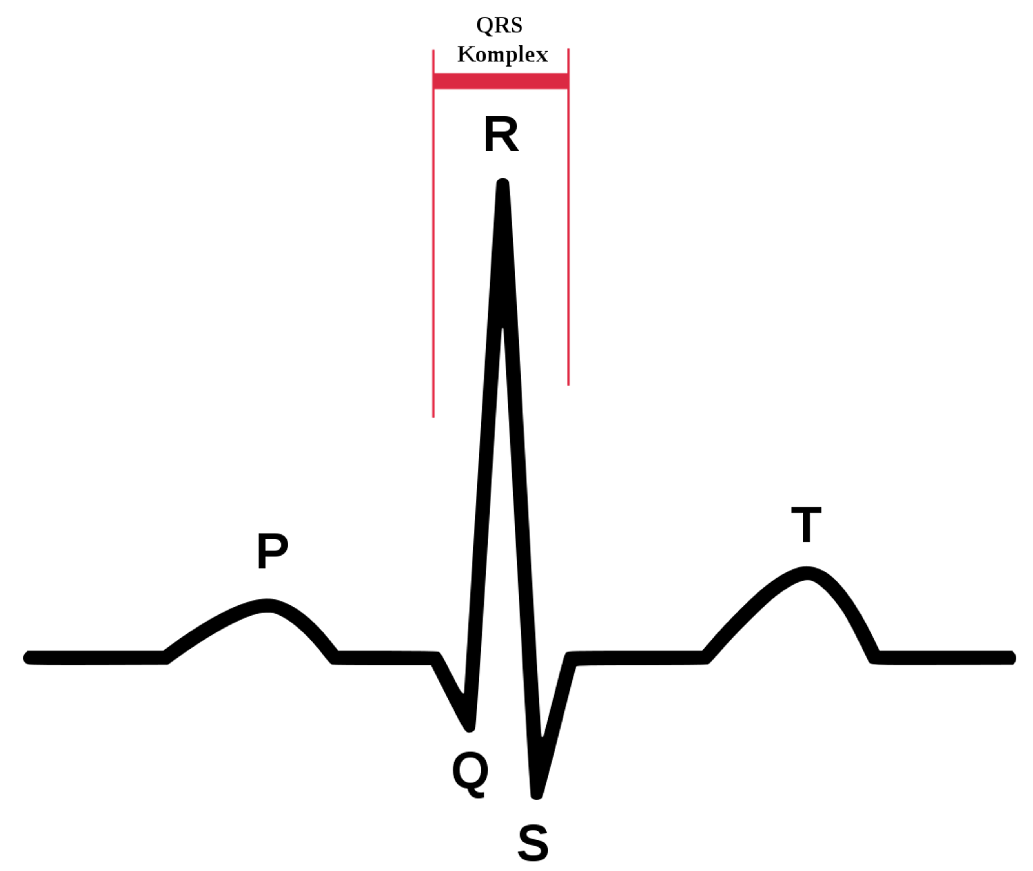 Sensors 23 05502 g004