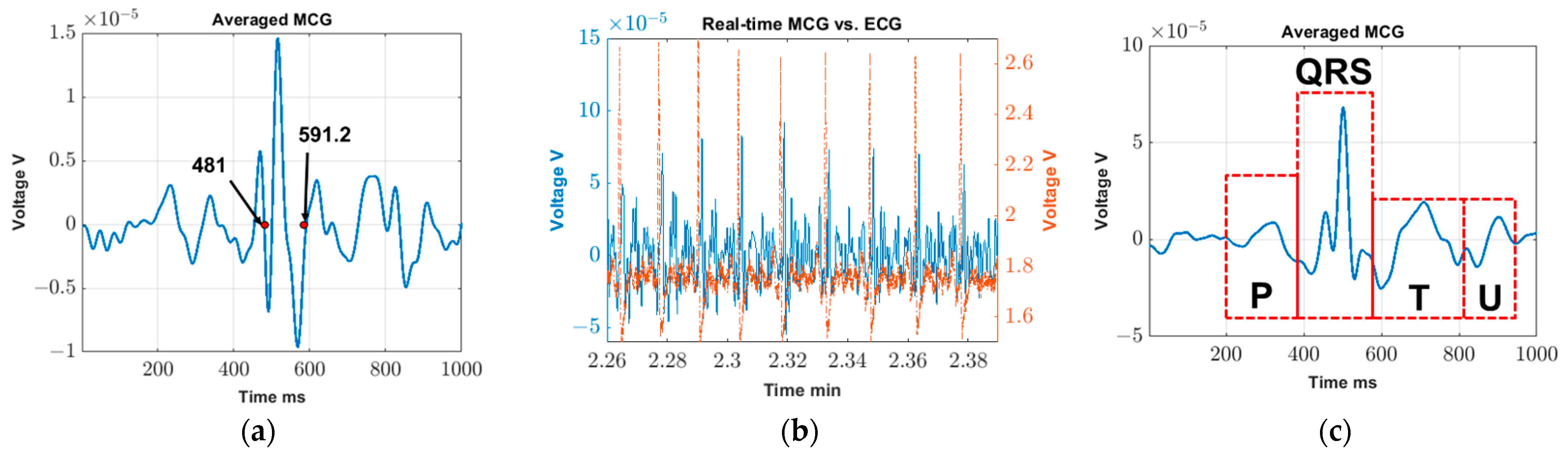 Sensors 23 05567 g003