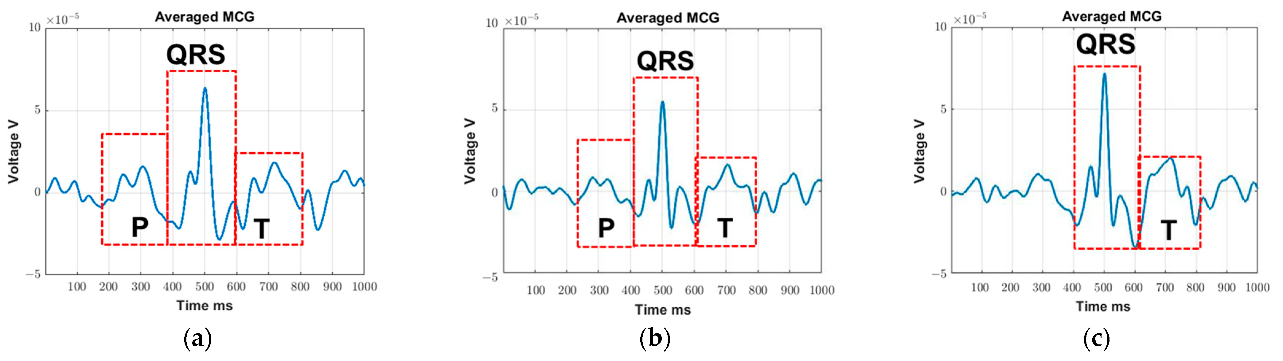 Sensors 23 05567 g004