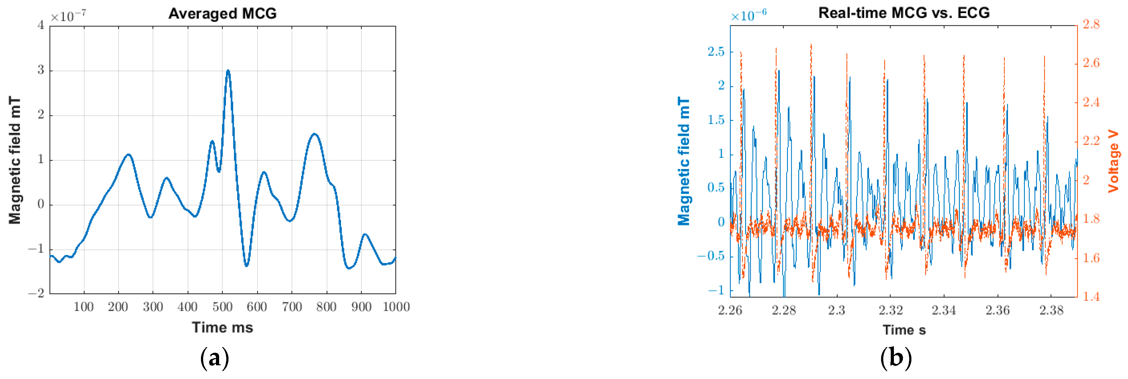 Sensors 23 05567 g0a1