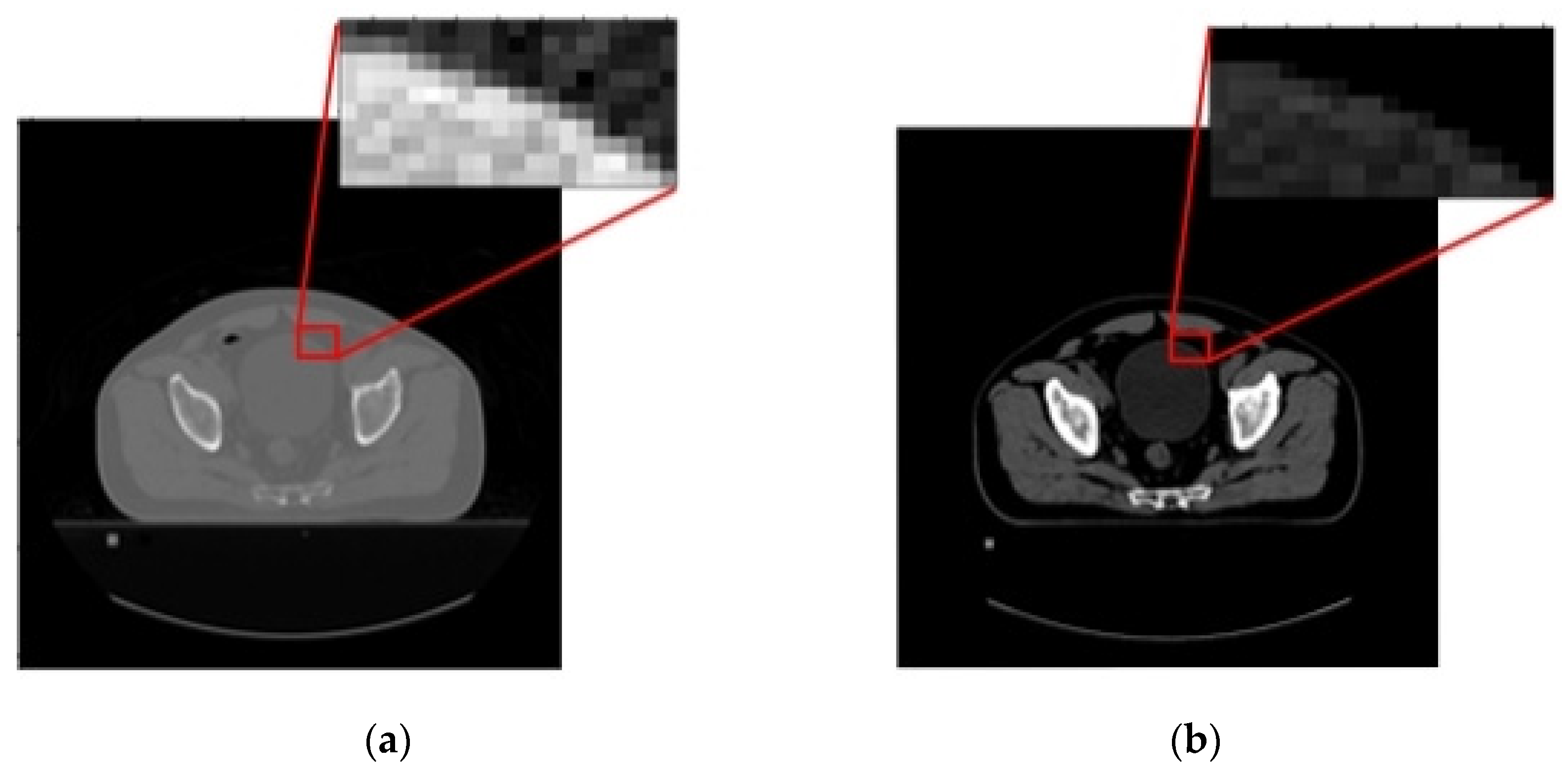 Sensors 23 05720 g006 Sensors 23 05720 g006