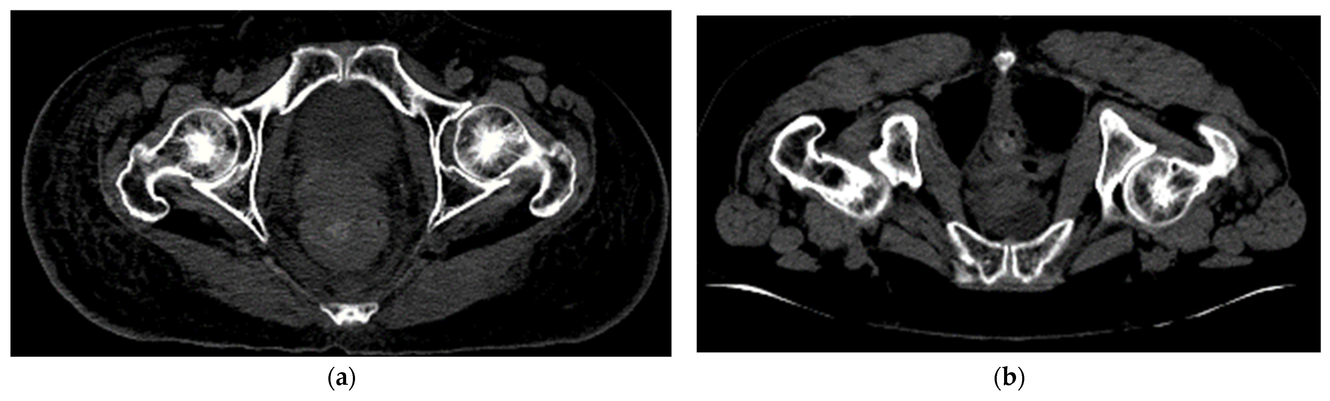 Sensors 23 05720 g009 Sensors 23 05720 g009