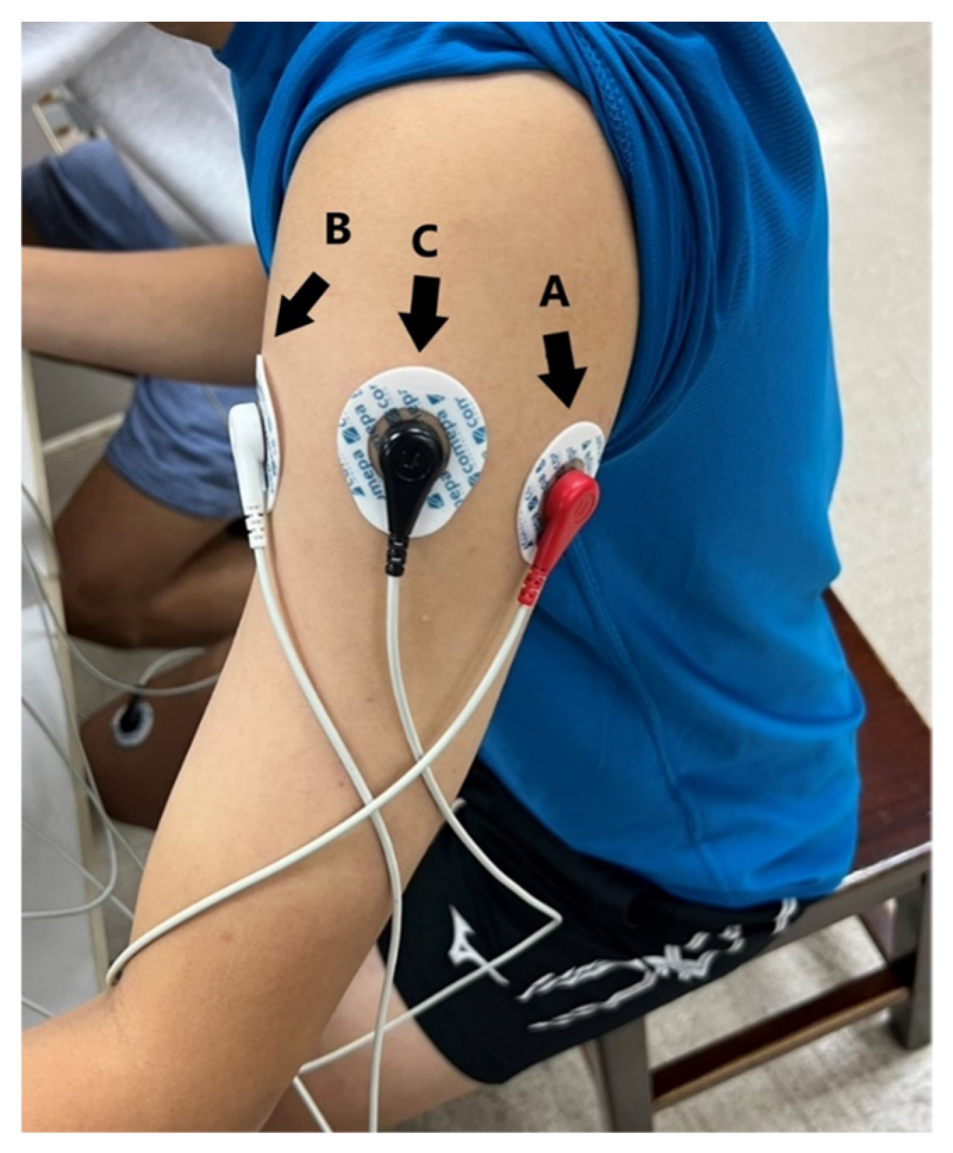 Sensors 23 05818 g003 Sensors 23 05818 g003