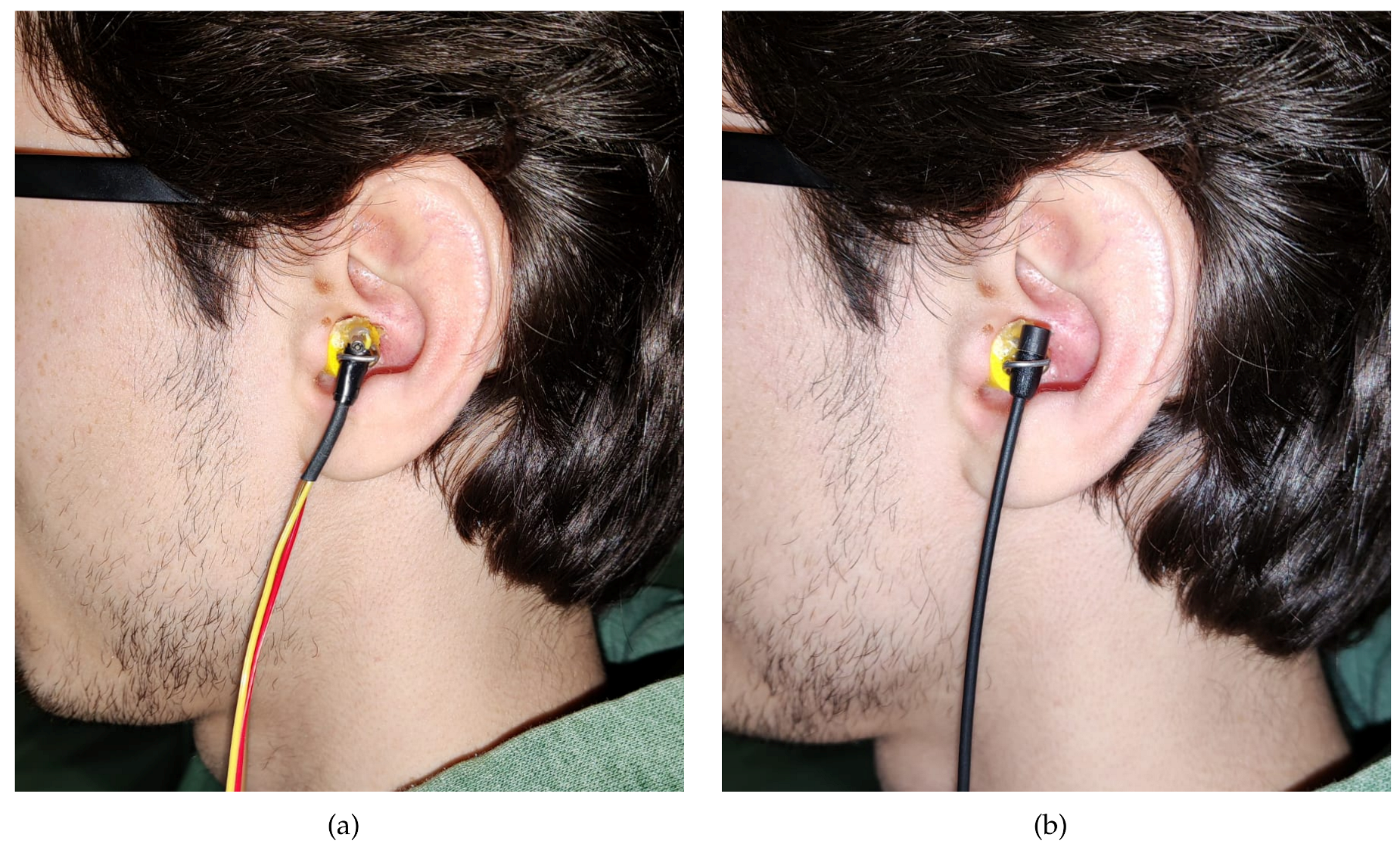 Sensors 23 06016 g007 Sensors 23 06016 g007