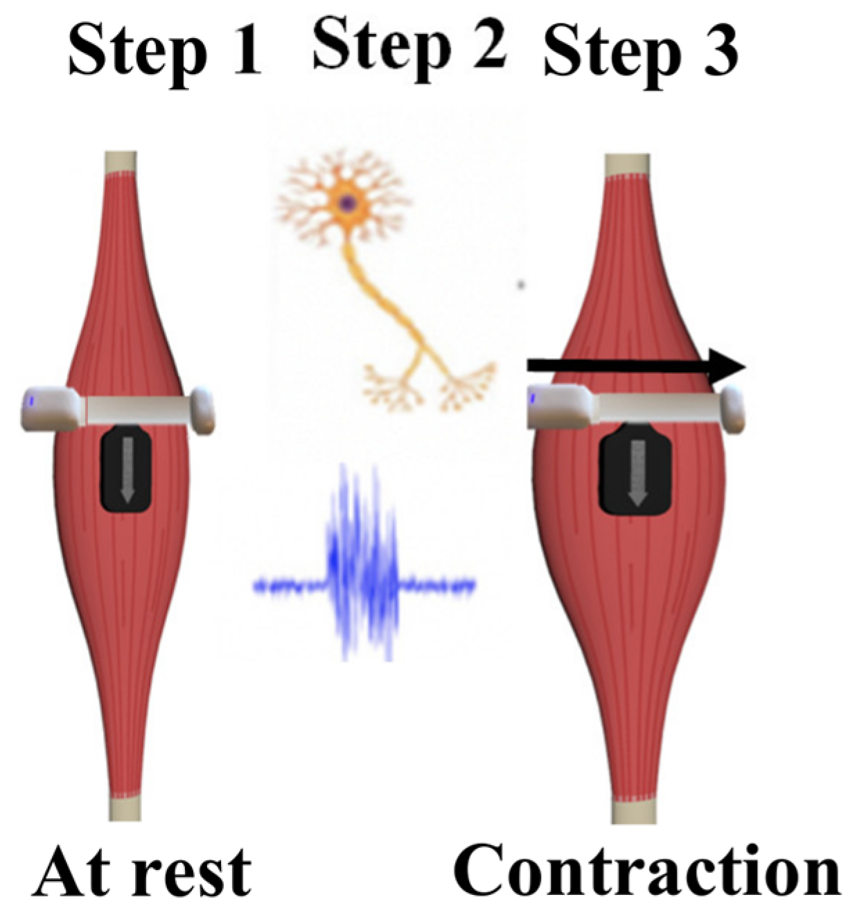 Sensors 23 06031 g002