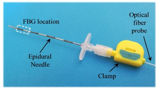 Long Length Epidural Anesthesia Needles
