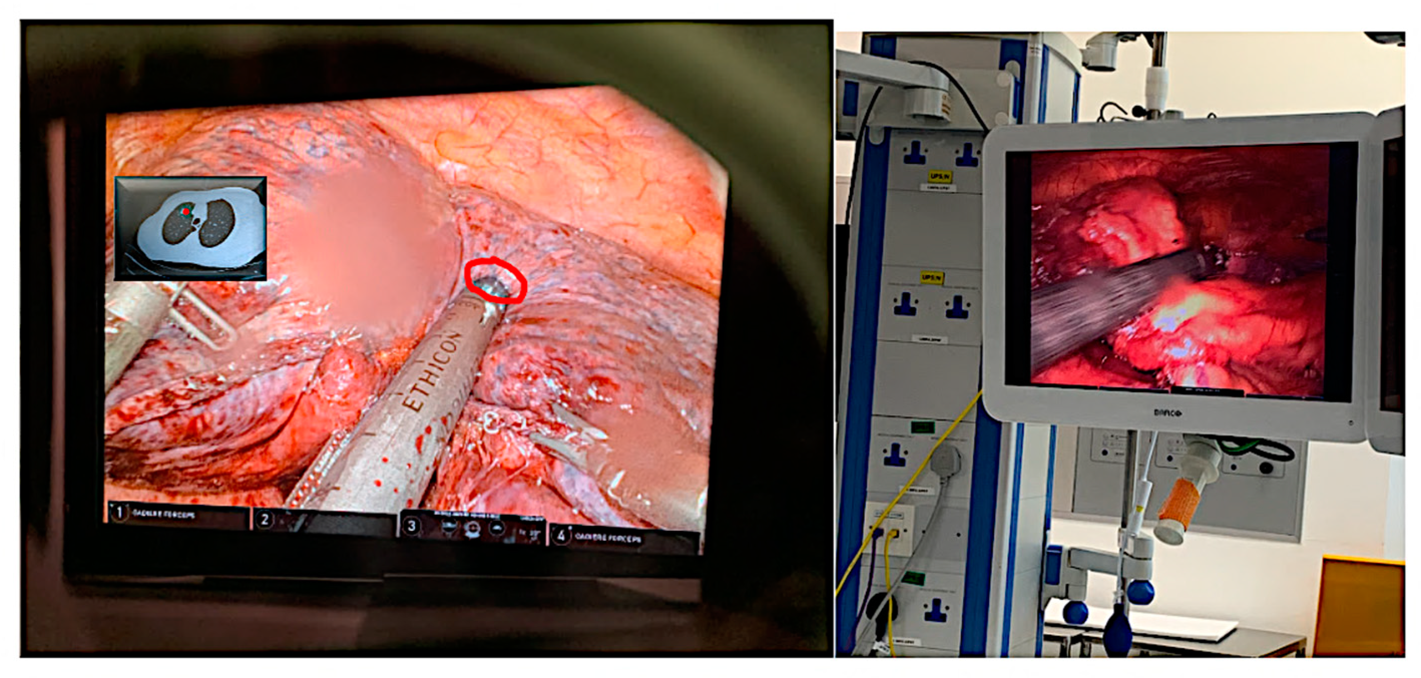 Sensors 23 06202 g006