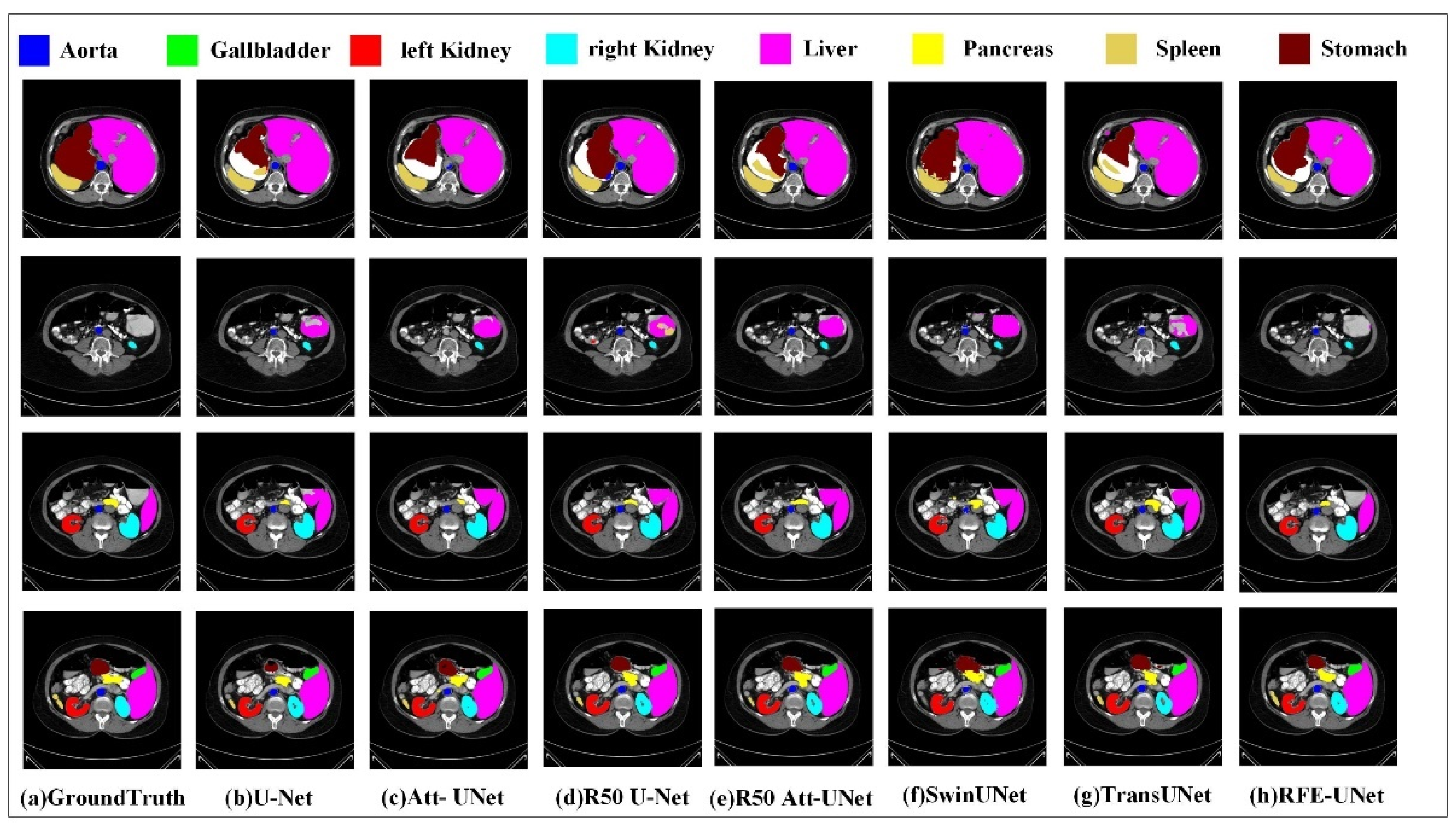Sensors 23 06228 g006