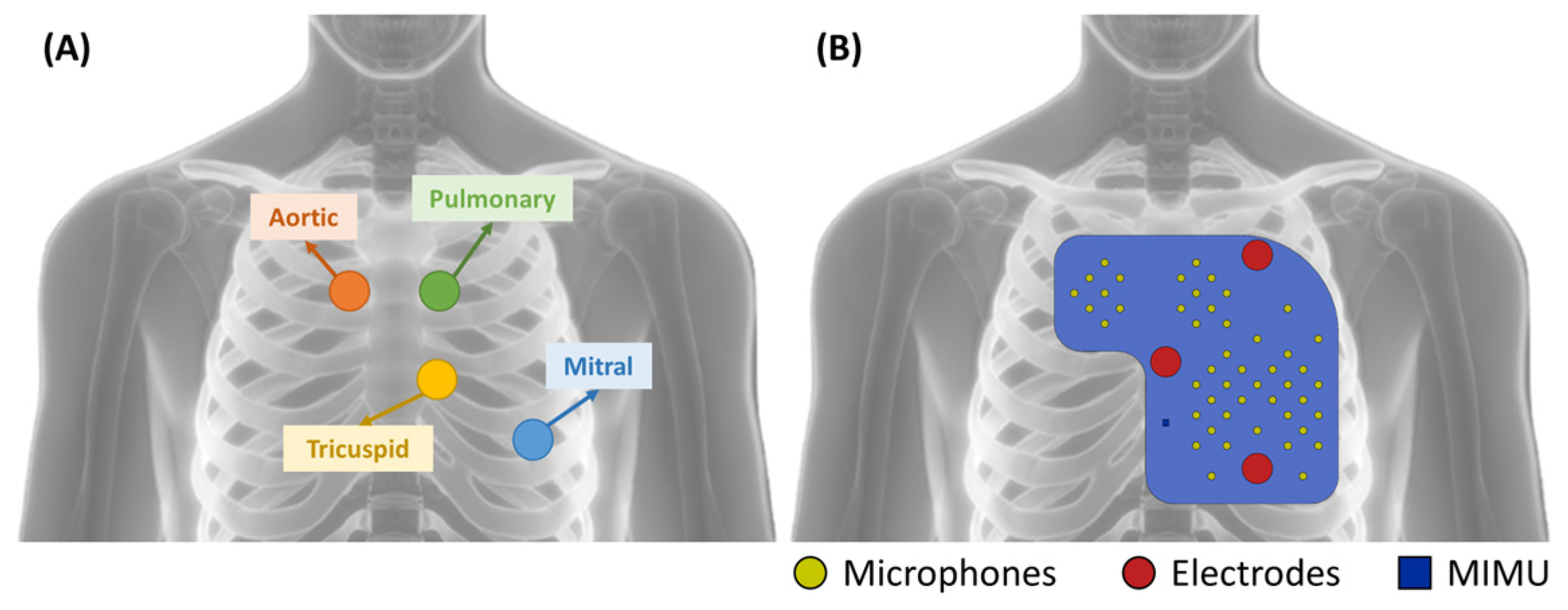 Sensors 23 06241 g002