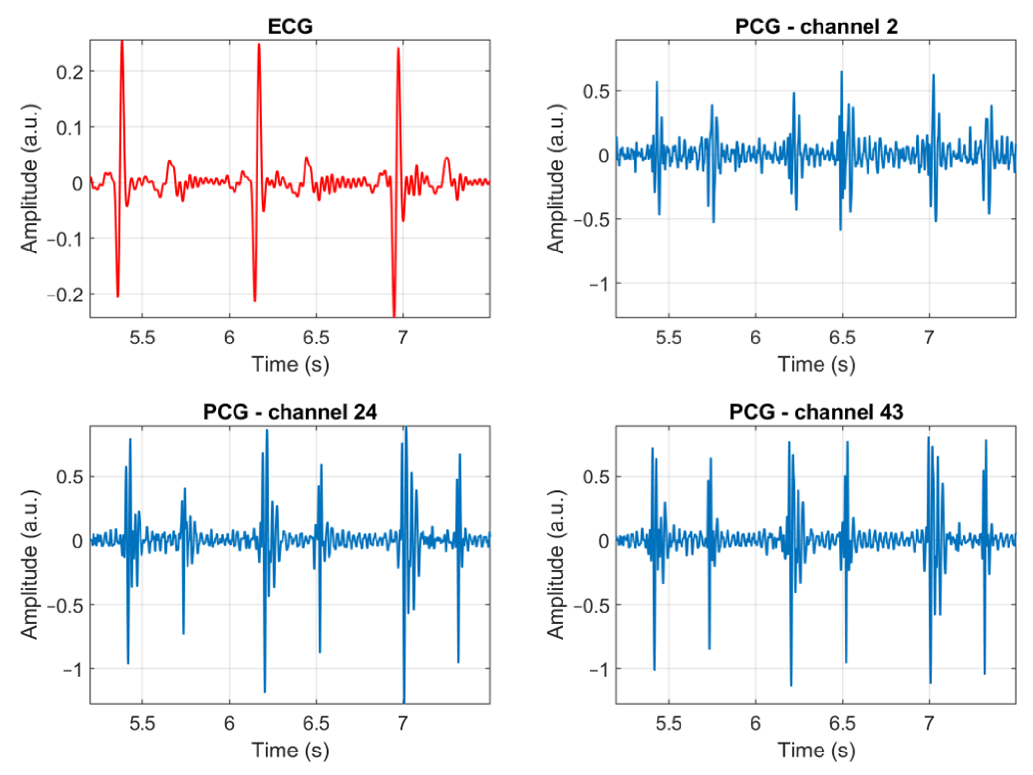 Sensors 23 06241 g007