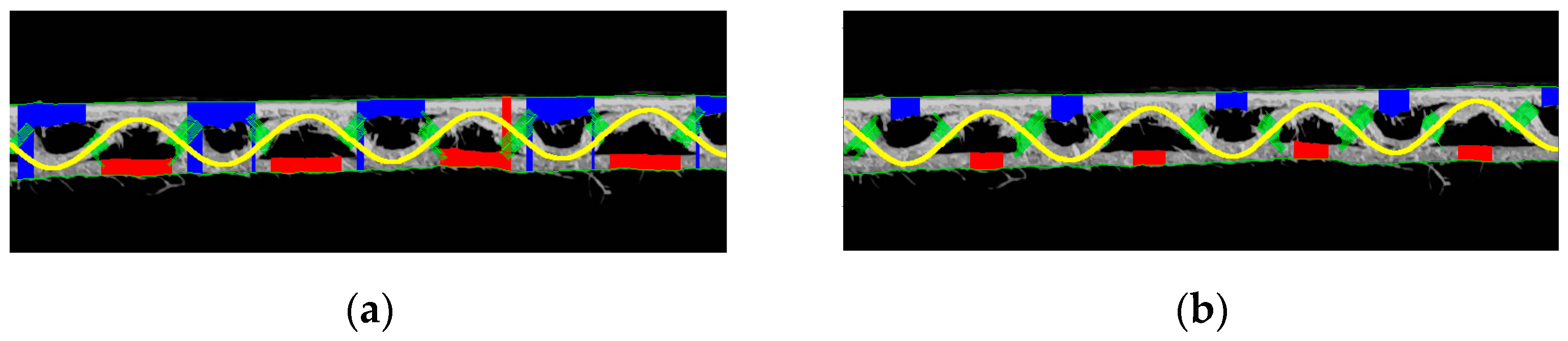 Sensors 23 06242 g017