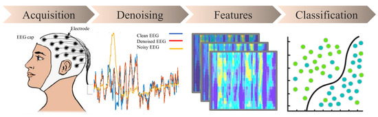 EEG AI Processing