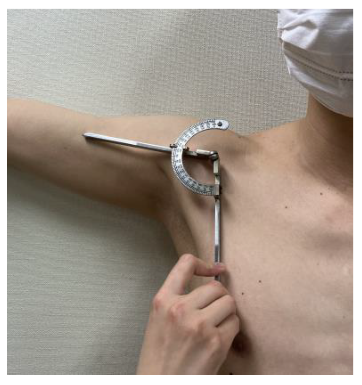 Sensors 23 06445 g001