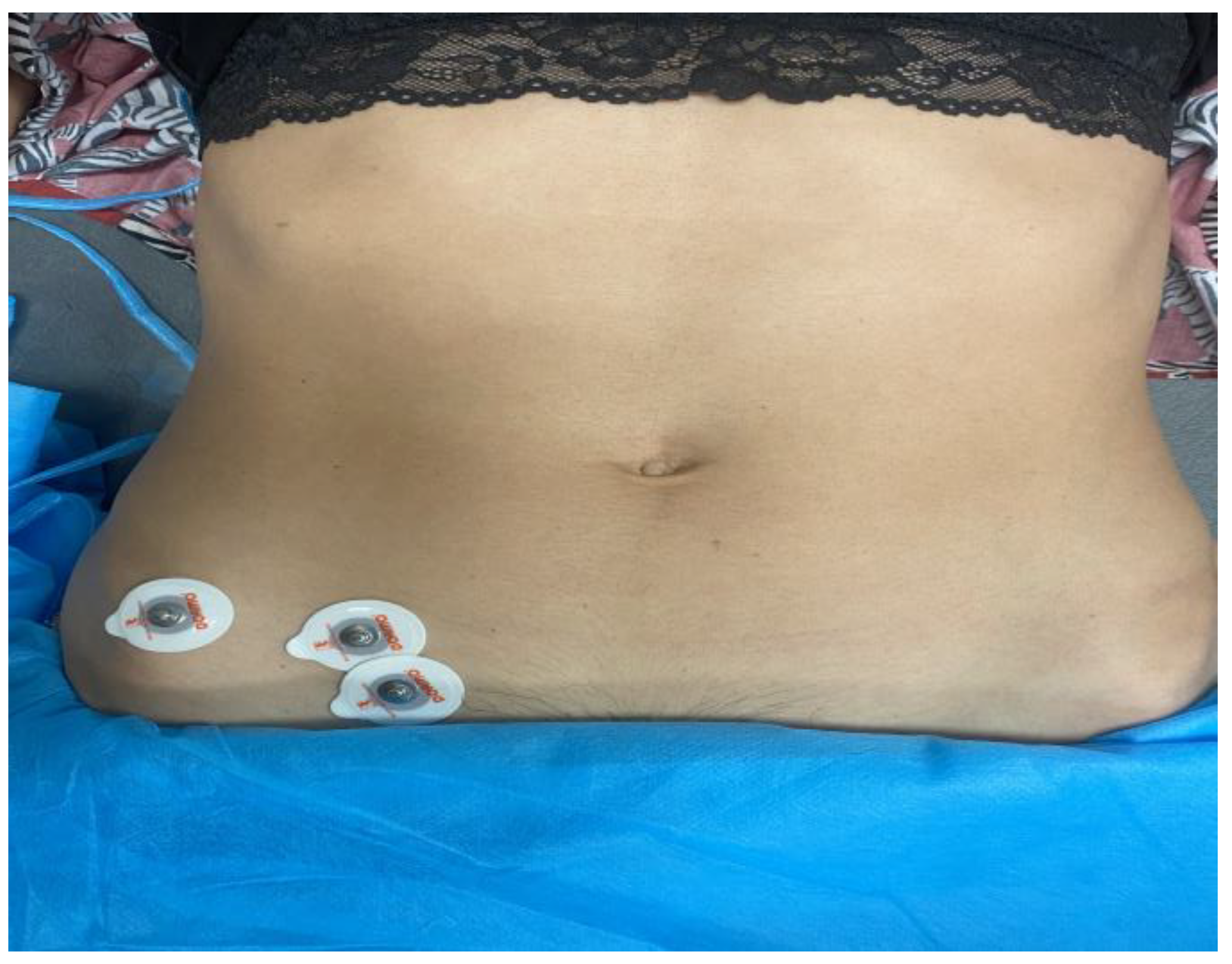 Sensors 23 06496 g002