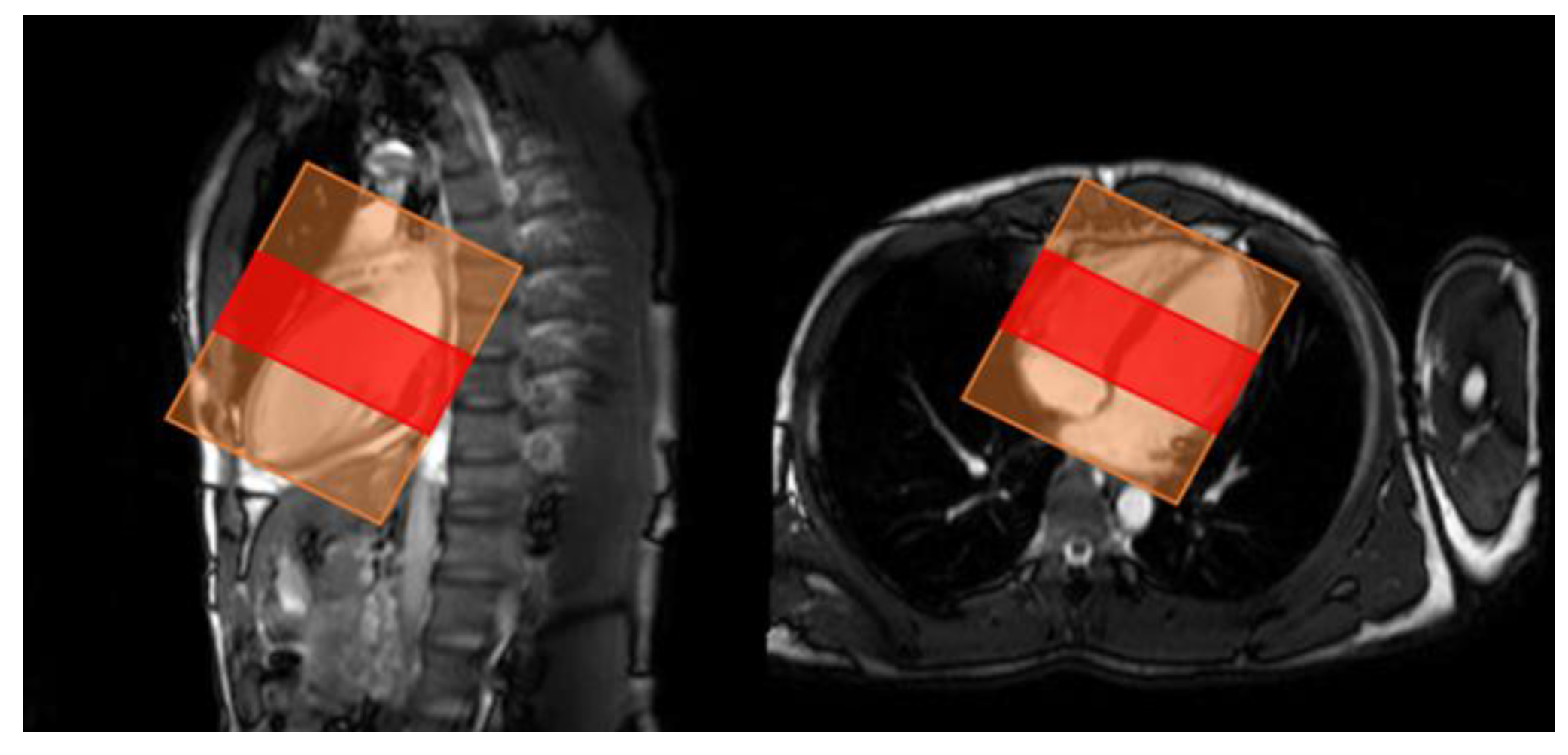 Sensors 23 06580 g002 Sensors 23 06580 g002