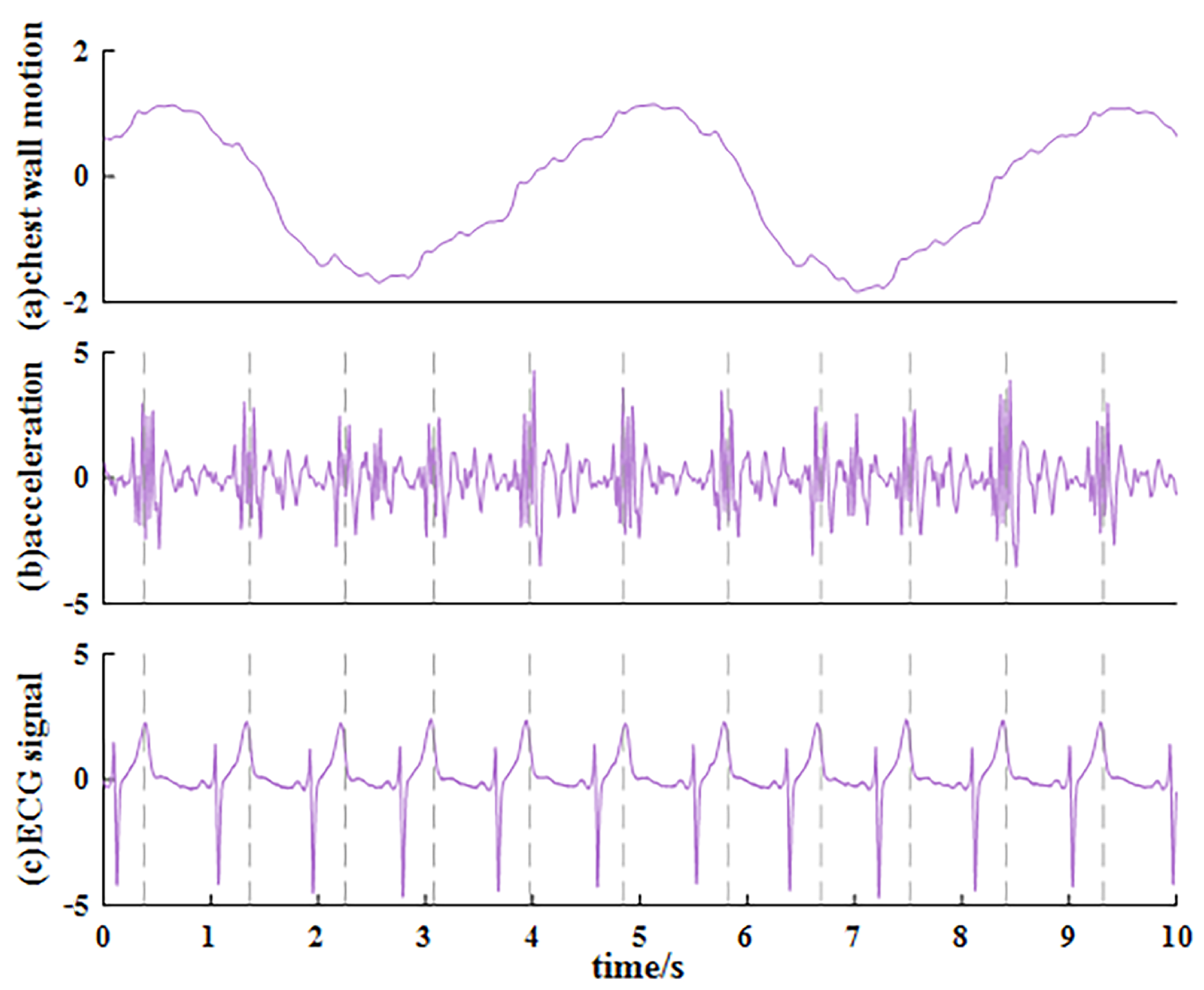 Sensors 23 06681 g003