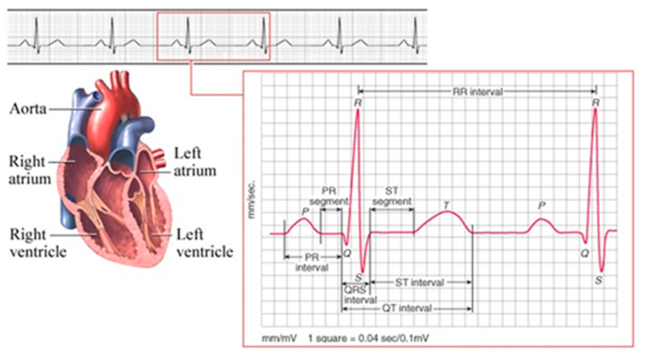 Sensors 23 07010 g006 550