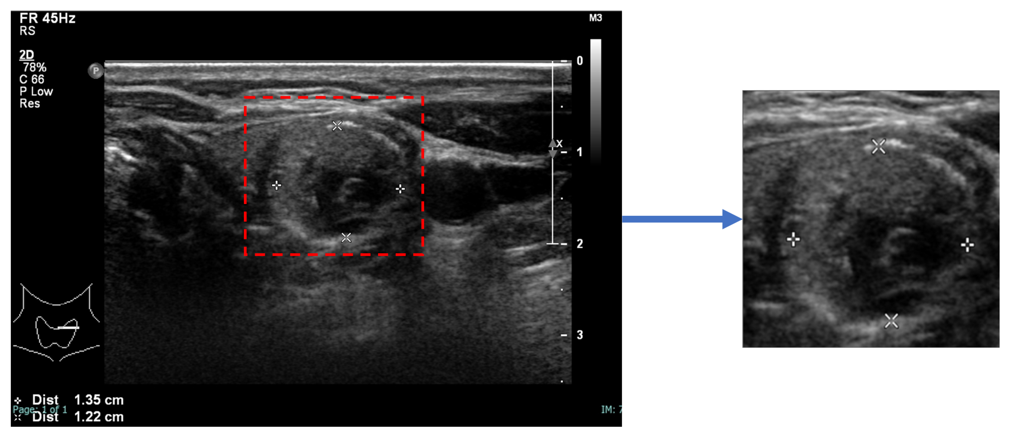 Sensors 23 07289 g002