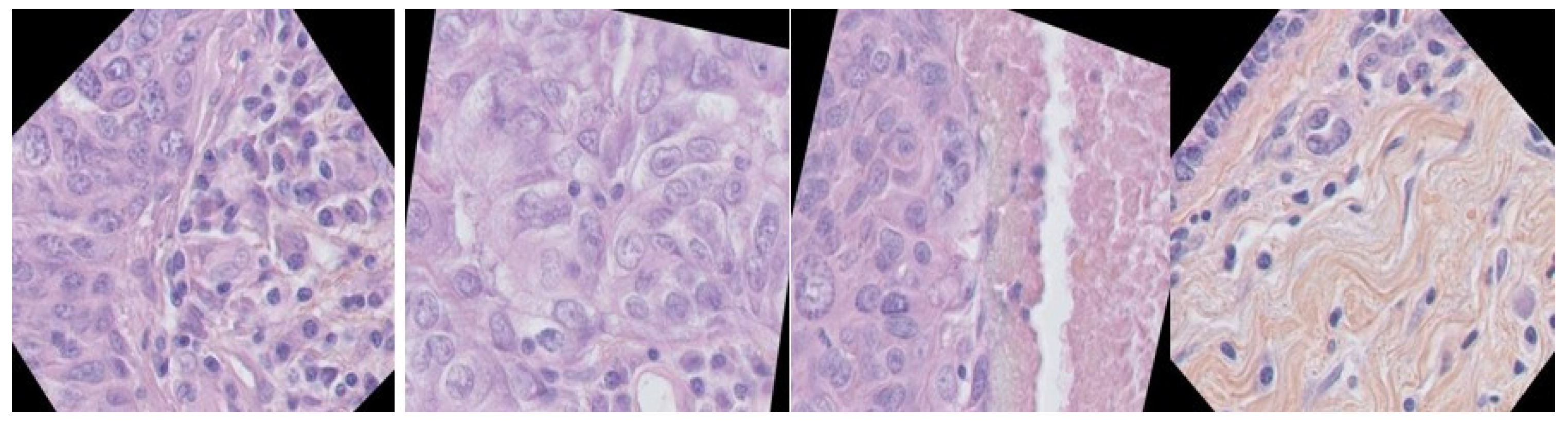 Sensors 23 07318 g004