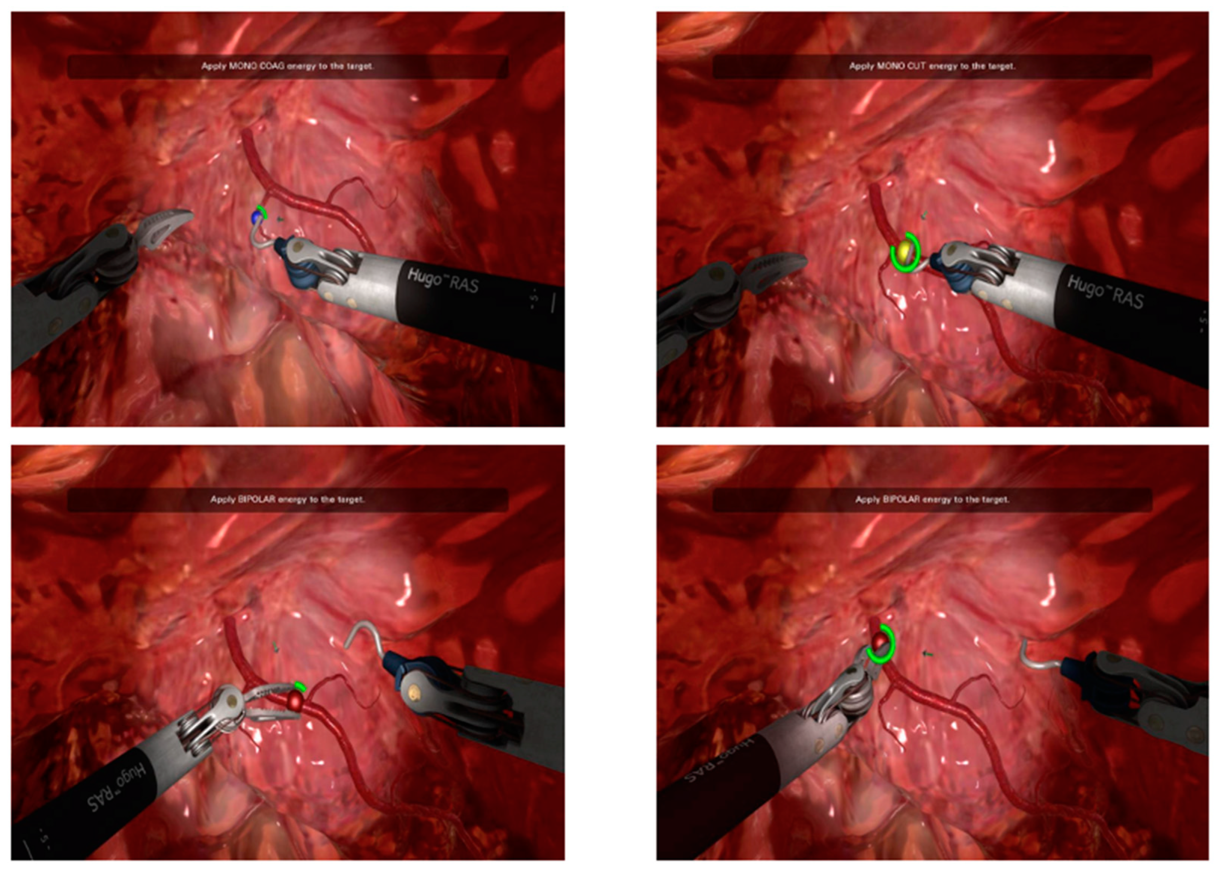 Sensors 23 07348 g002