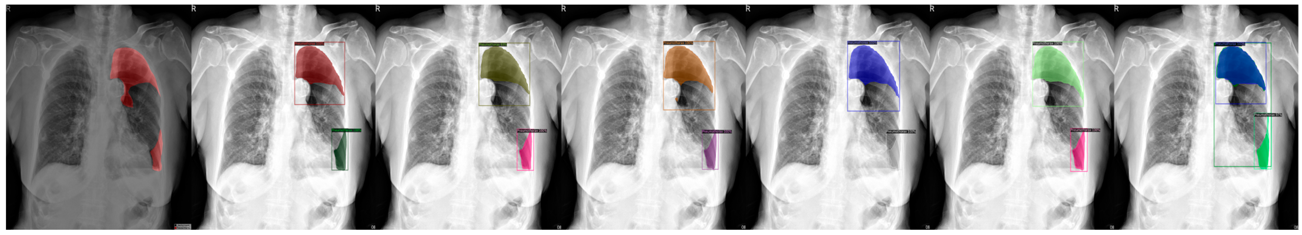 Sensors 23 07369 g005 Sensors 23 07369 g005