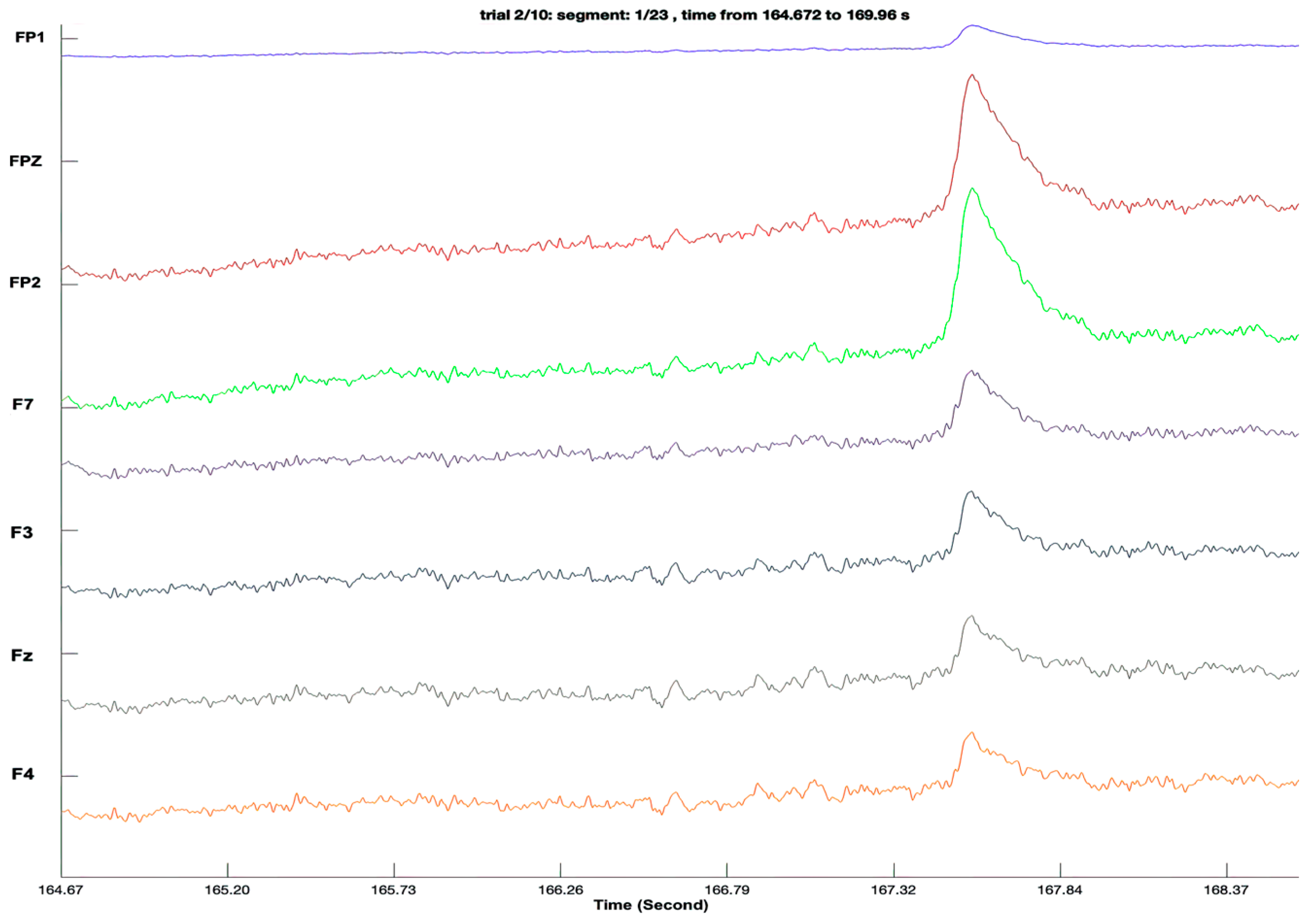 Sensors 23 07440 g005