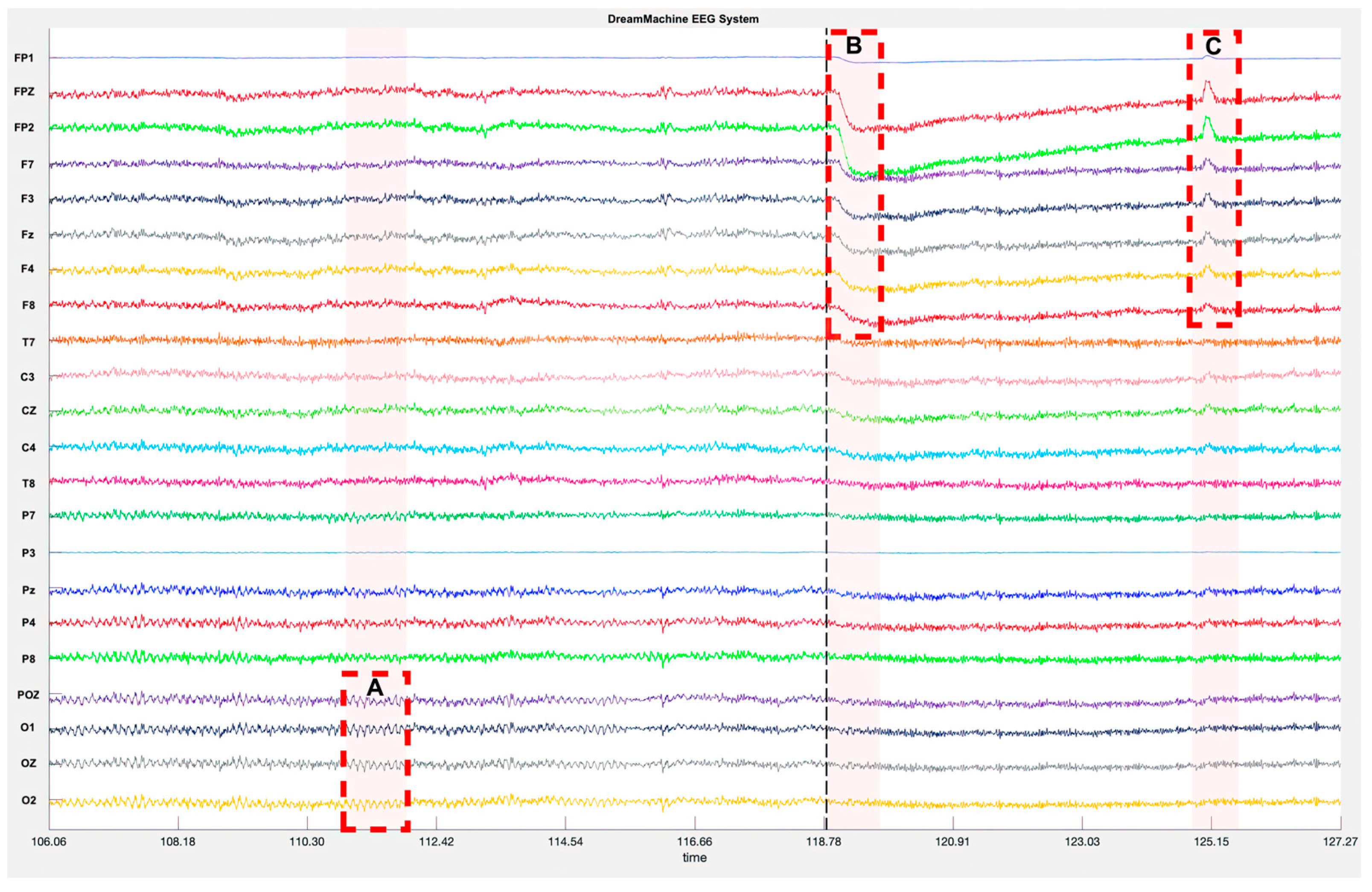 Sensors 23 07440 g007
