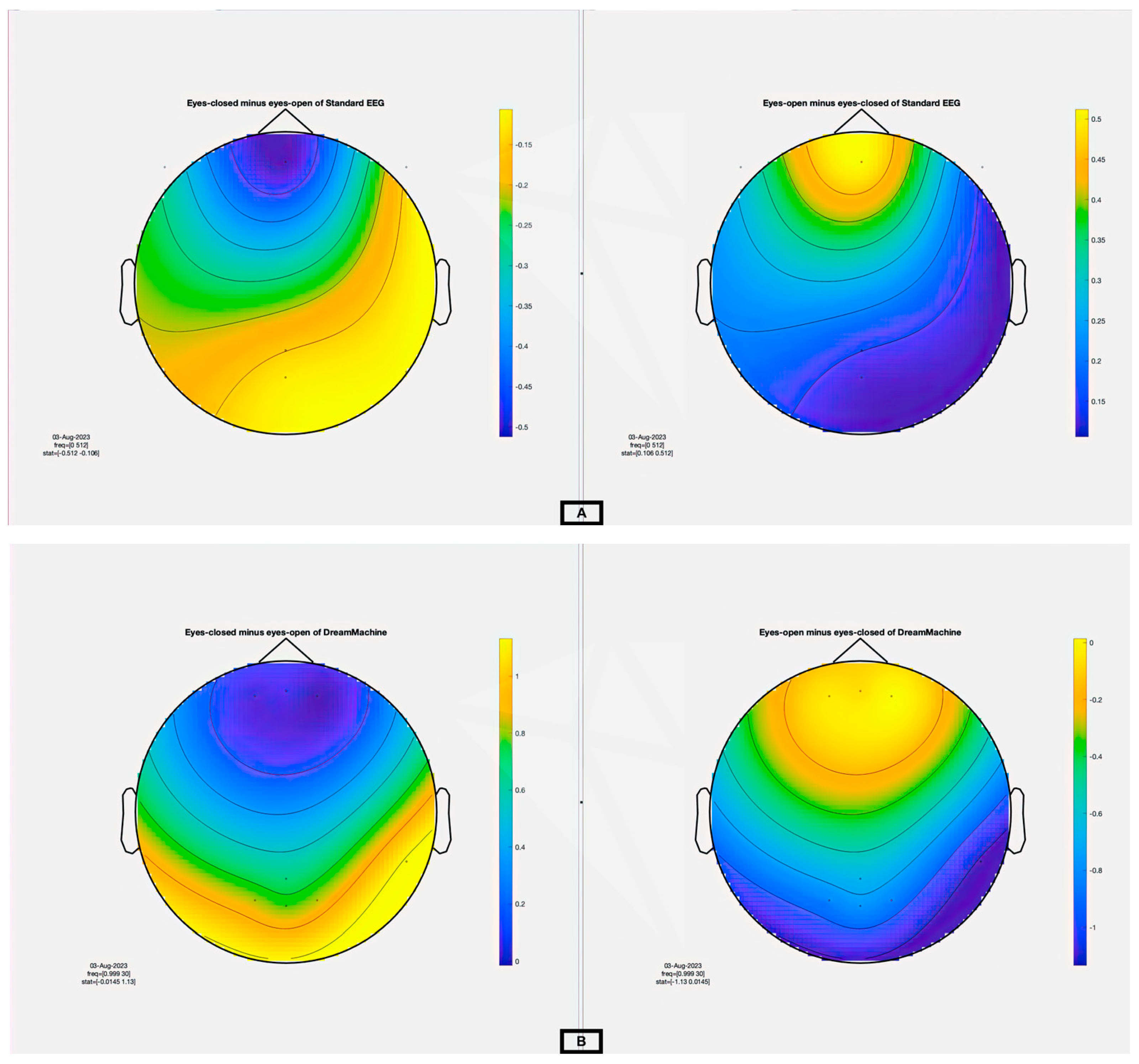Sensors 23 07440 g008