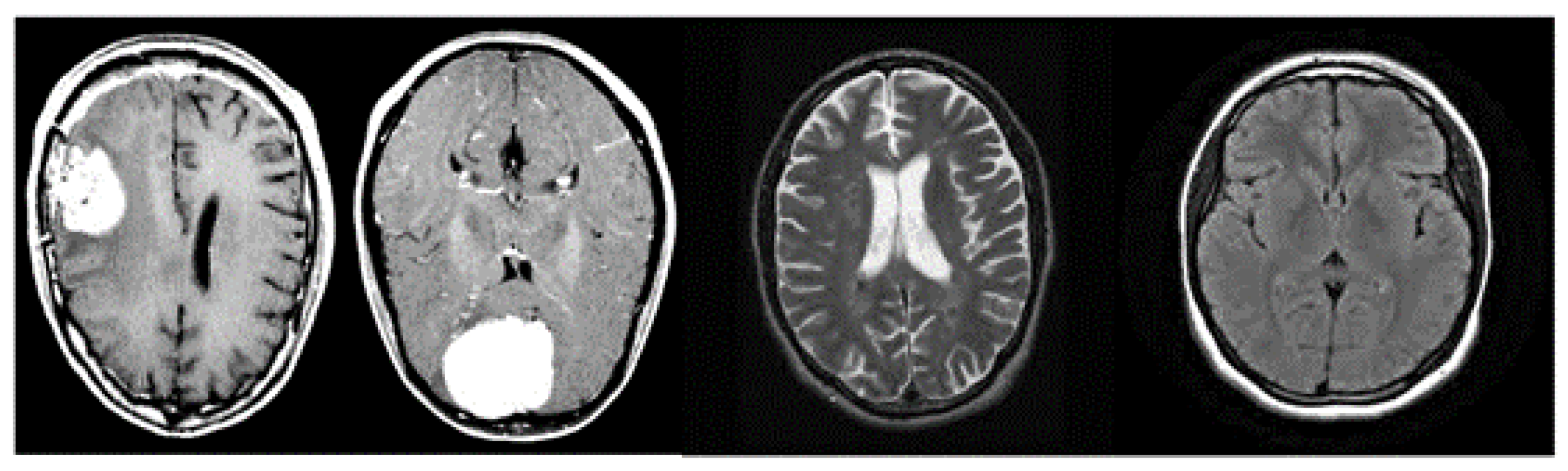Sensors 23 07614 g002