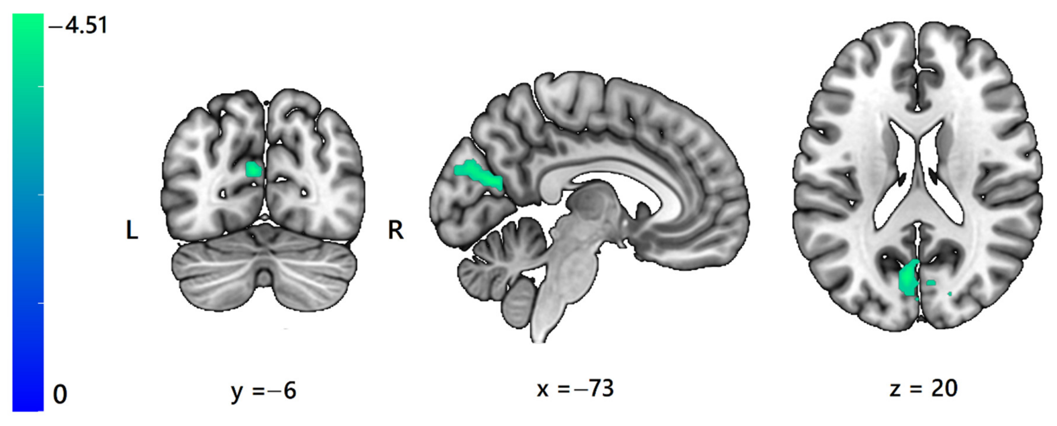 Sensors 23 07881 g003