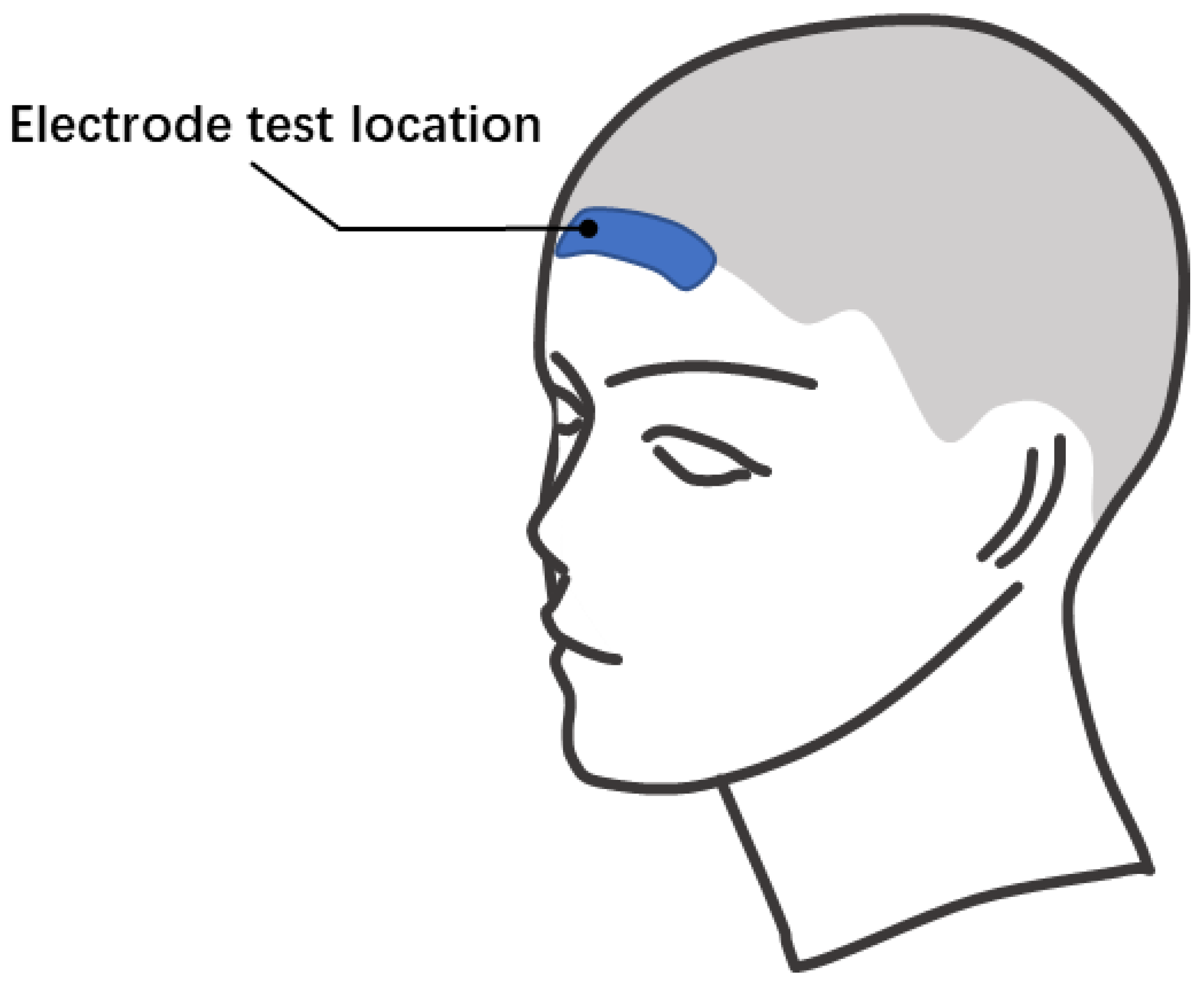 Sensors 23 07887 g004