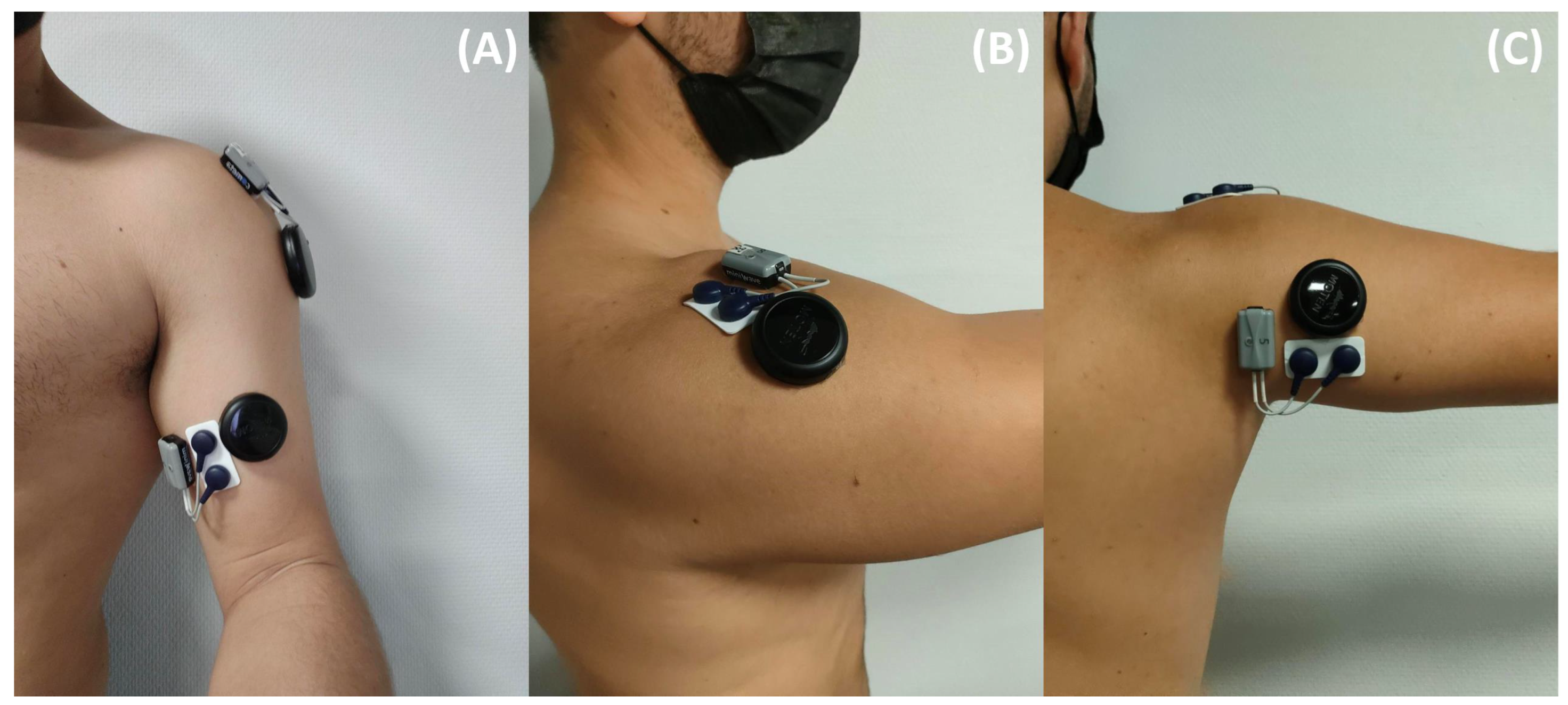 Later anterior deltoid head Electrode Placement for Compex Muscle