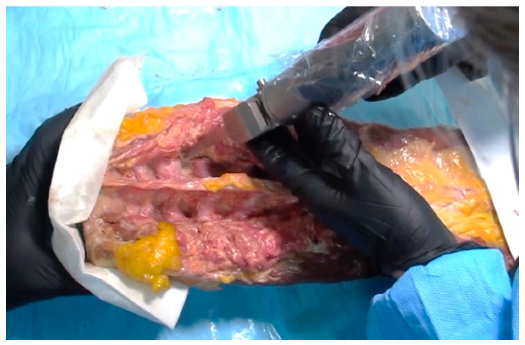 Sensors 23 08001 g001