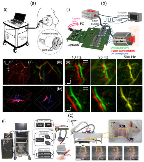 Review of Three-Dimensional Handheld Photoacoustic and Ultrasound ...