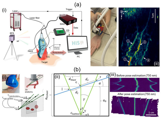 Review of Three-Dimensional Handheld Photoacoustic and Ultrasound ...